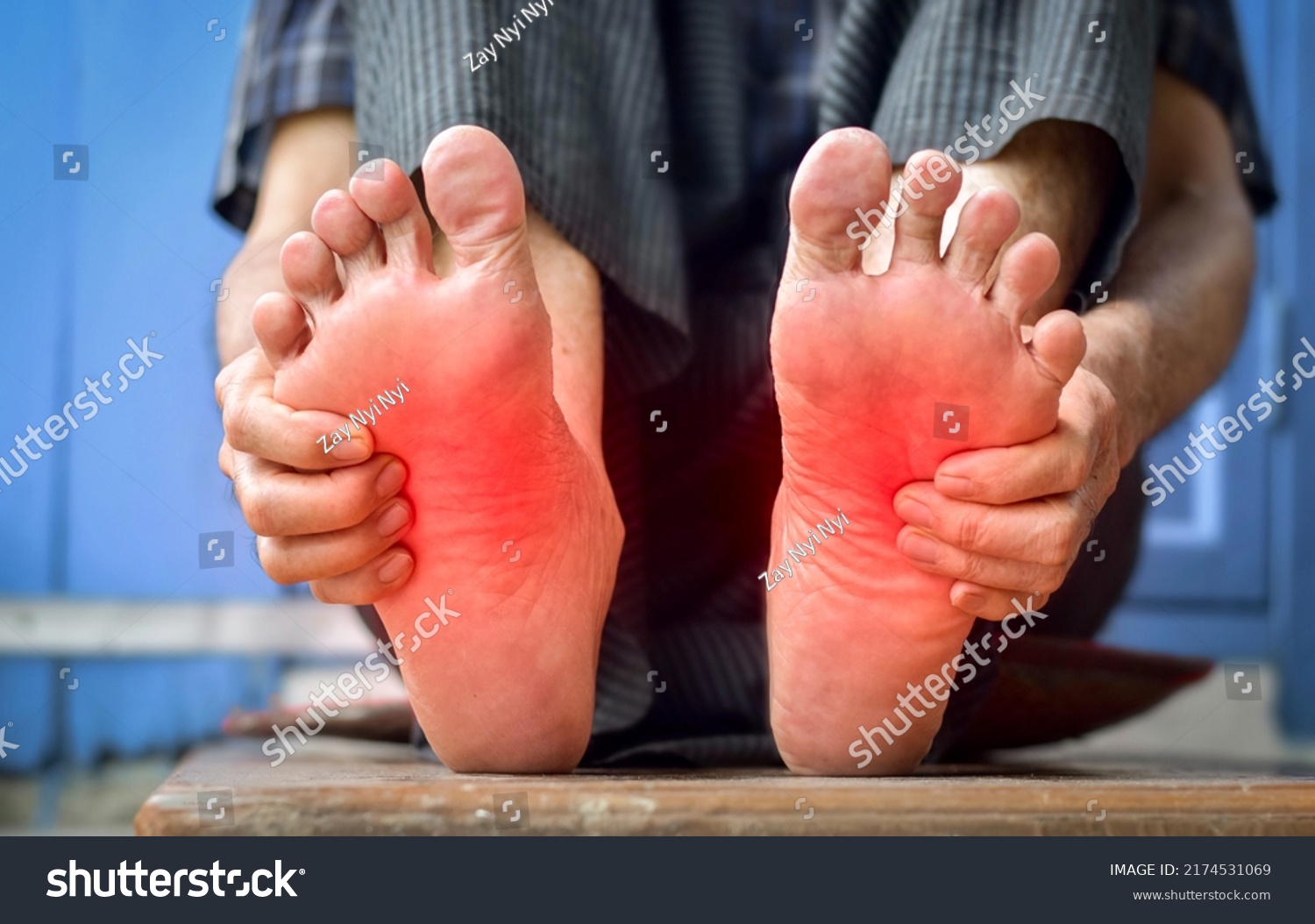 Tingling and burning sensation in feet of Asian old man with diabetes. Foot pain. Sensory neuropathy problems. Foot nerves problems. Plantar fasciitis. #2174531069