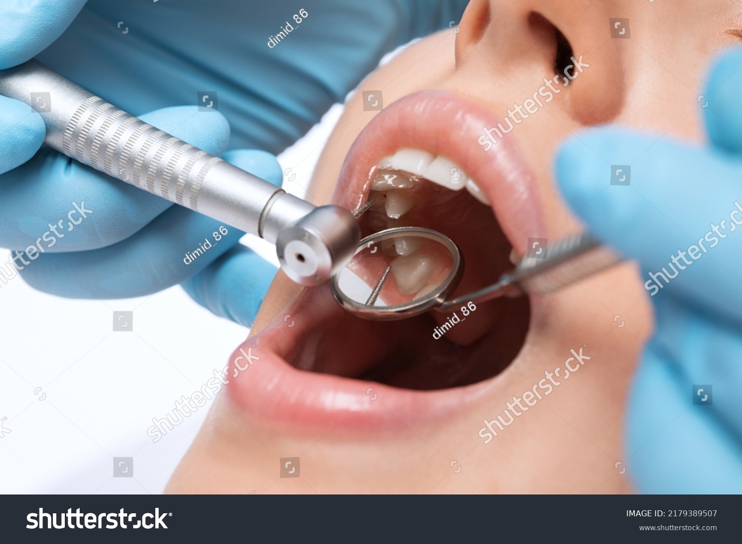 A dentist doctor treats caries on a tooth of a young beautiful woman in a dental clinic. Tooth filling. #2179389507