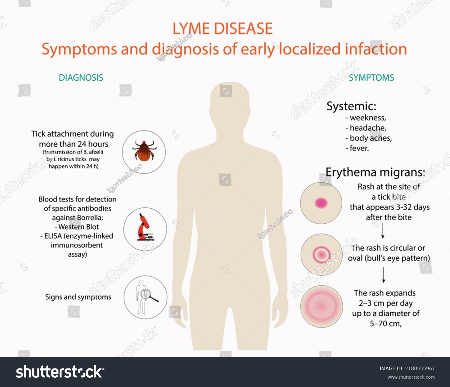 Symptoms and diagnosis of Lyme disease, vector, - Royalty Free Stock ...