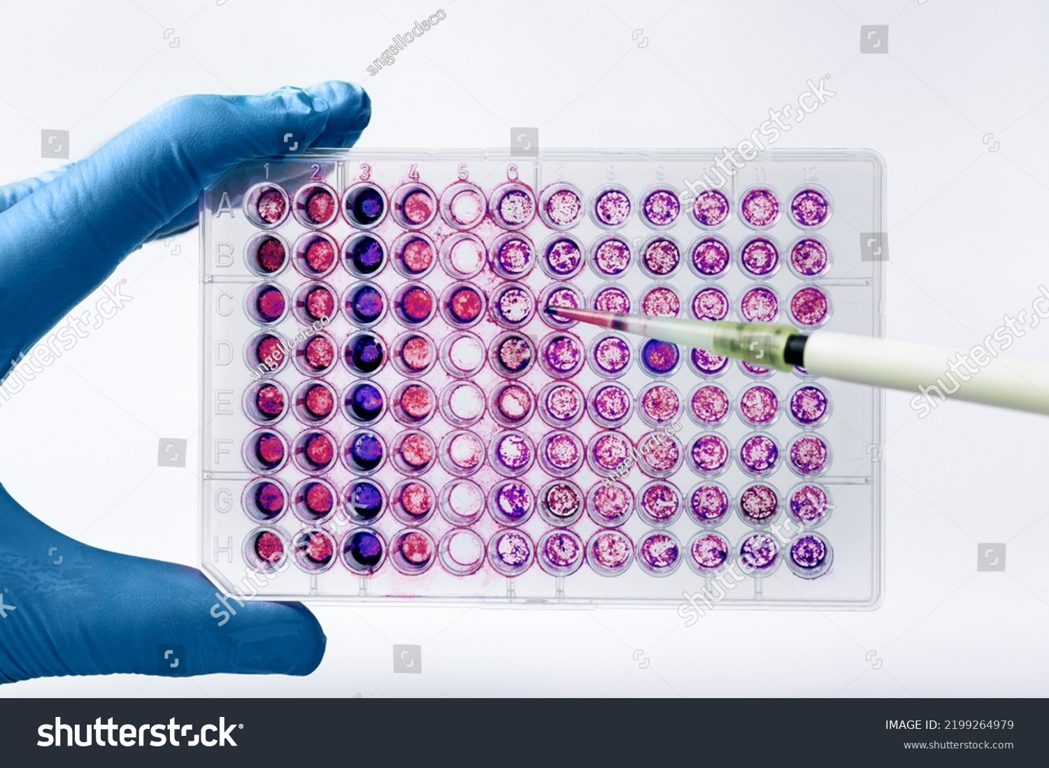 Researcher experimenting with a diagnostic plate in wells with culture medium. Scientist pipetting biological samples of cells into a 96-well microplate #2199264979