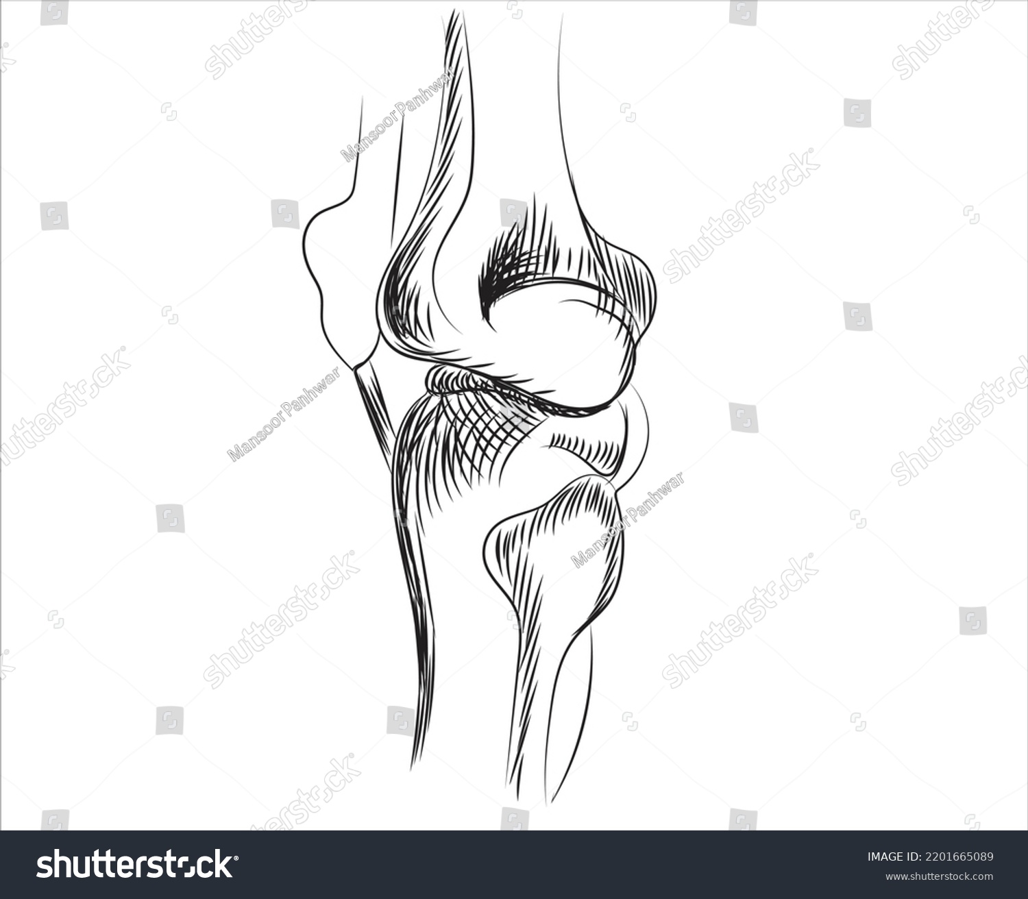 Line drawing of knee osteoarthritis -The - Royalty Free Stock Vector ...