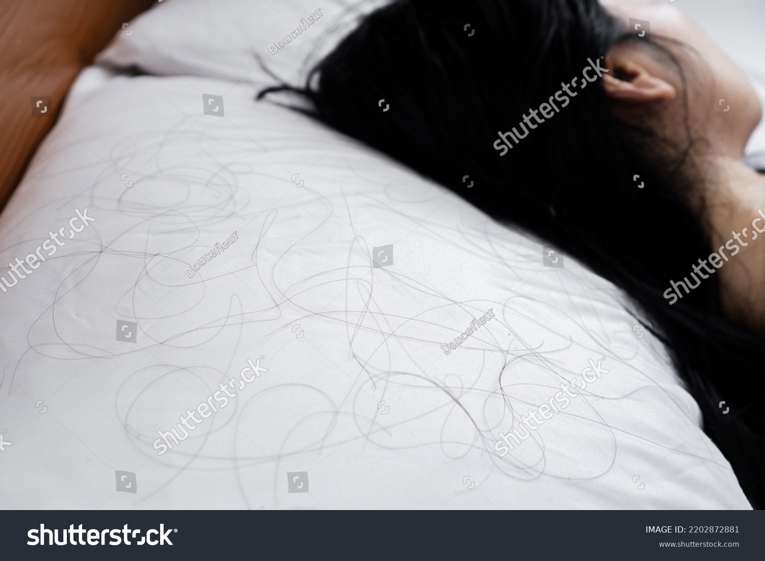closeup hair loss fallen on pillow with blur background of woman sleeping in bed  #2202872881