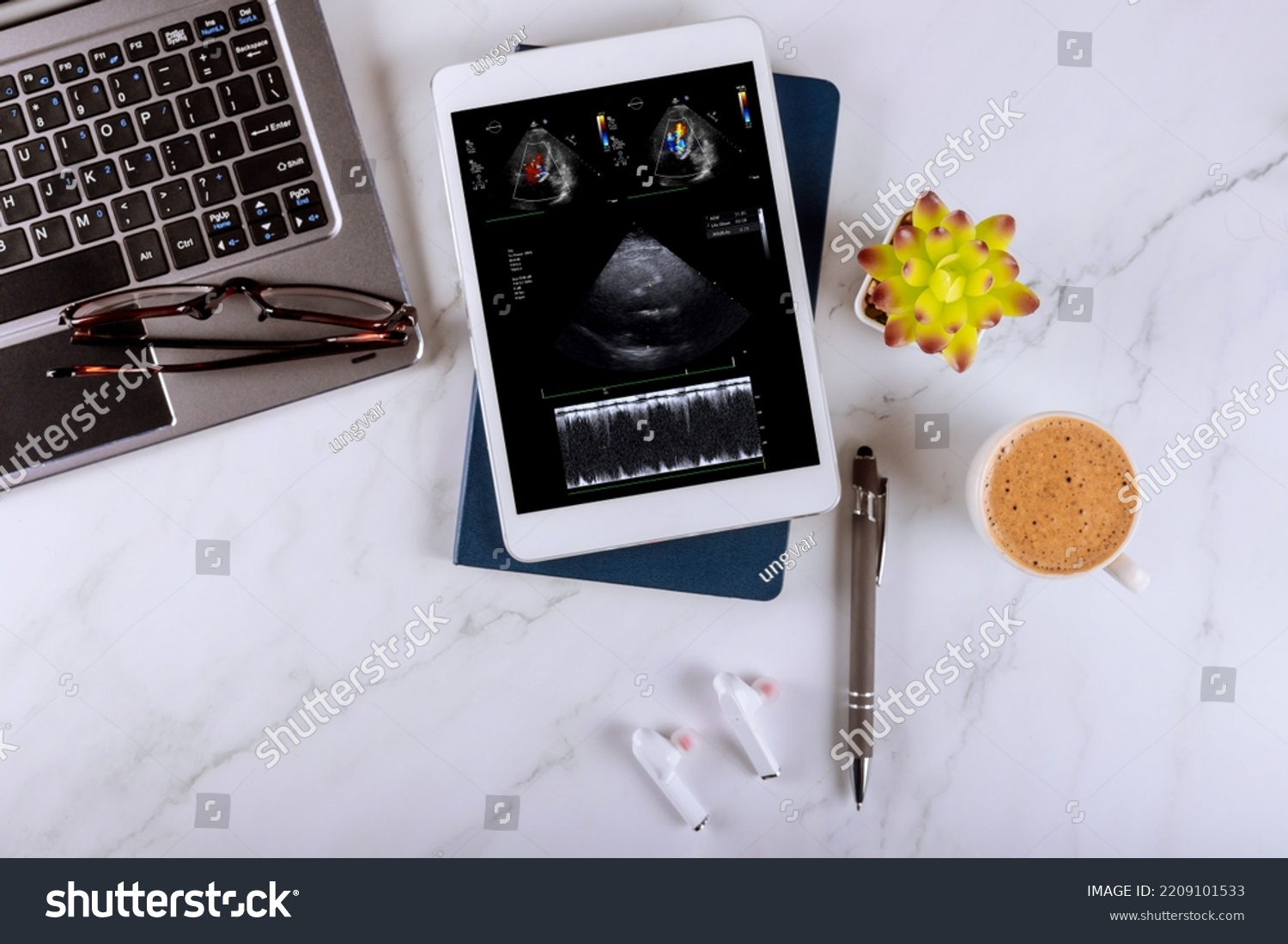 A doctor using a digital tablet examines the results echocardiography ultrasound of heart examination in order prescribe effective treatment to patient #2209101533