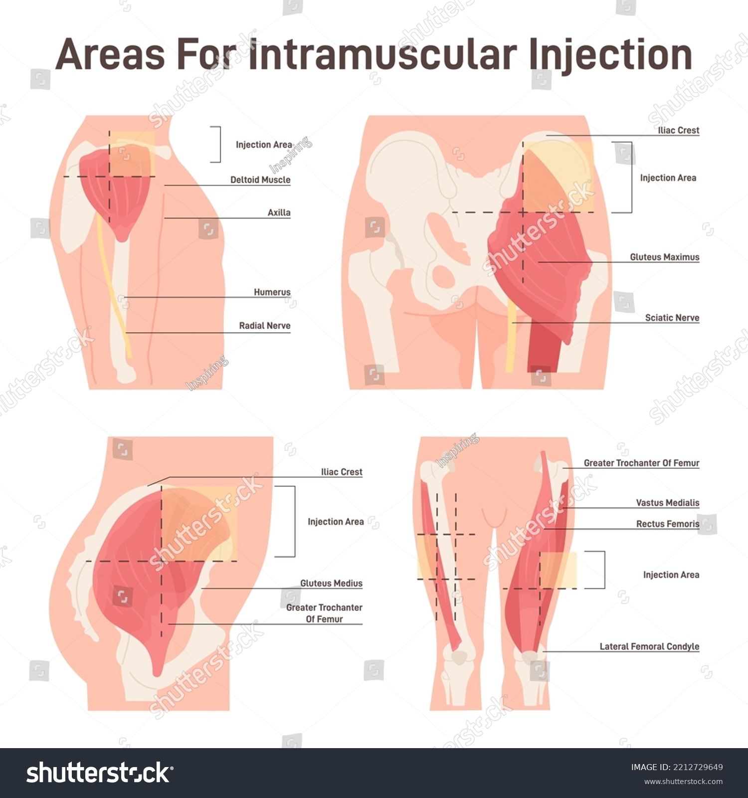 Intramuscular Injection Areas Guide To Royalty Free Stock Vector   Avopix 2212729649 