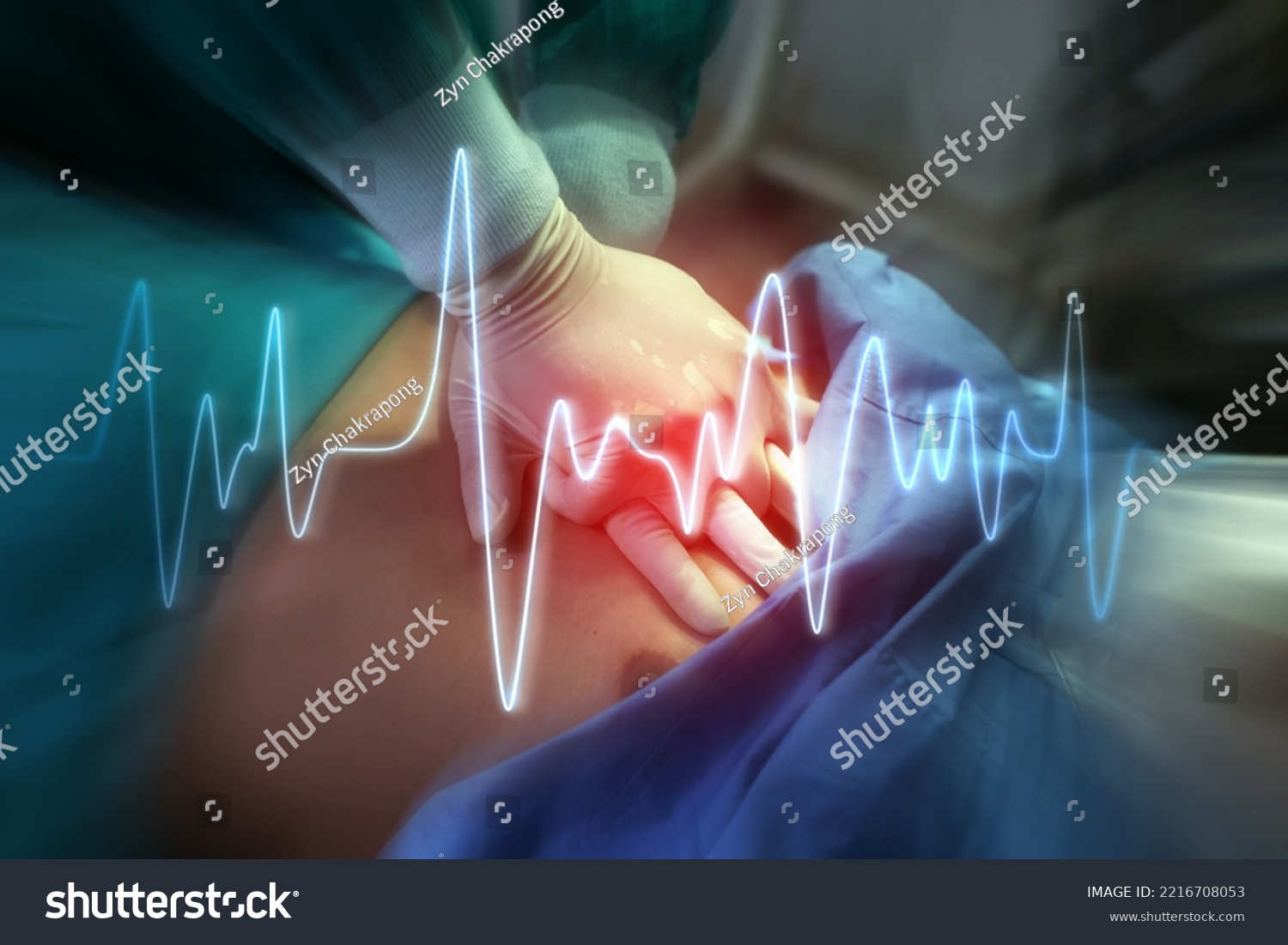 Hands of Doctor perform CPR on a patient in opertion room. #2216708053