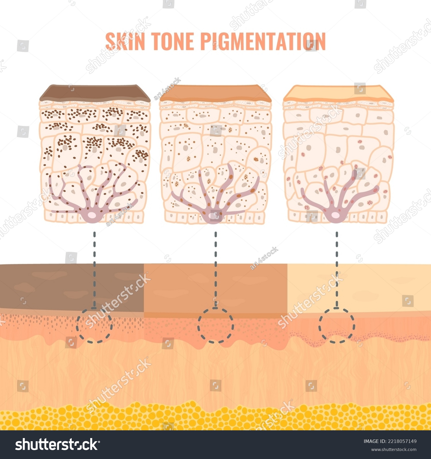 Melanin content and distribution in different - Royalty Free Stock ...