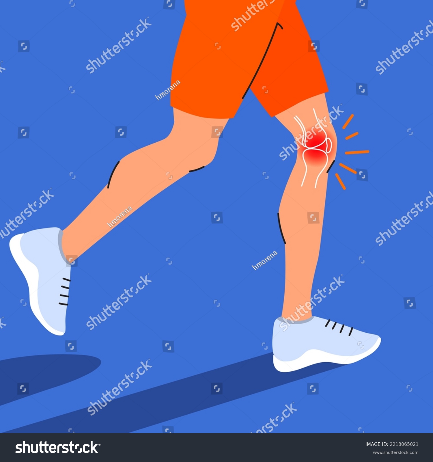 Runner with injured knee. Joint disease. Knee - Royalty Free Stock ...