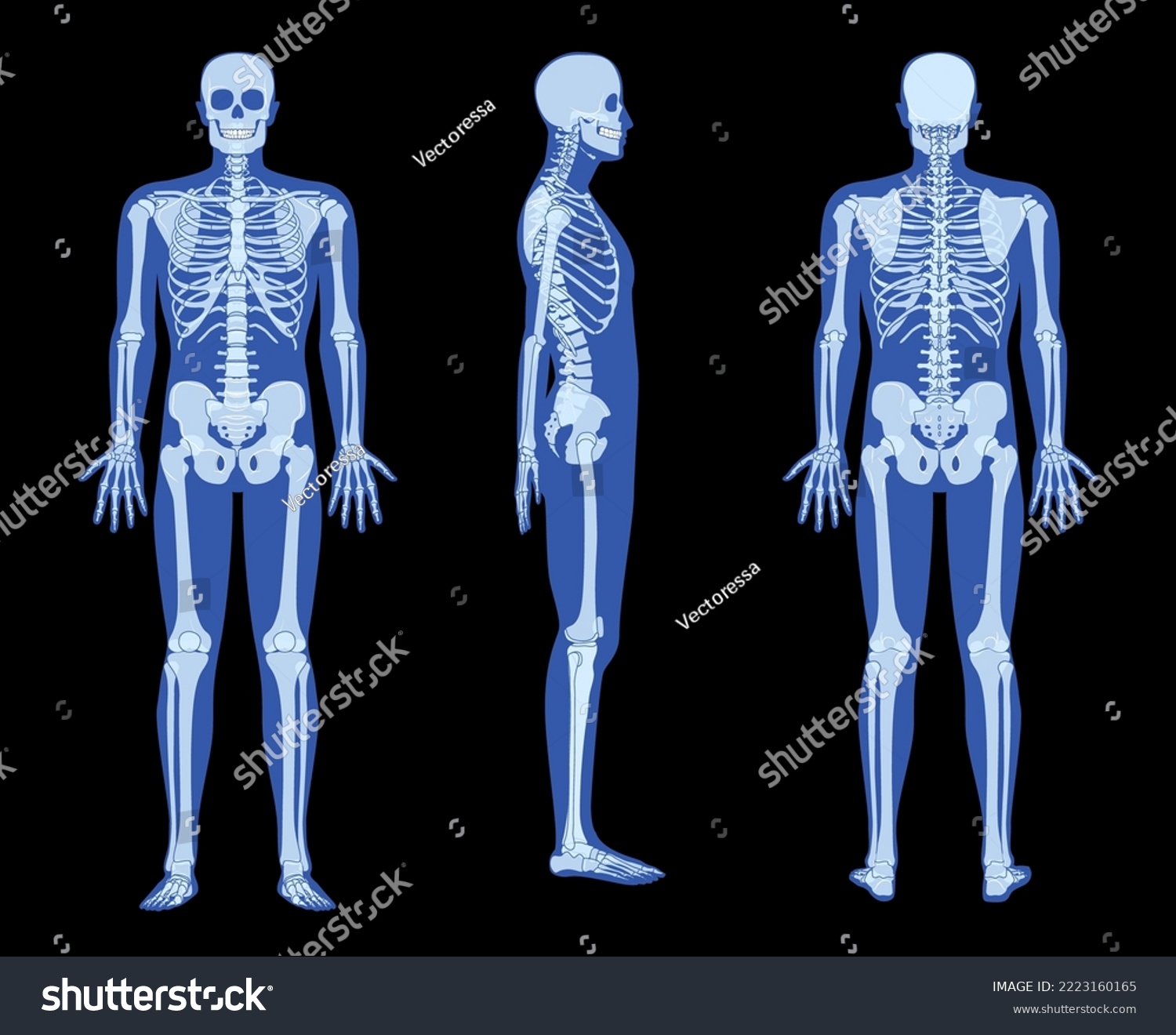 Set Of X Ray Skeleton Human Body Hands Legs Royalty Free Stock