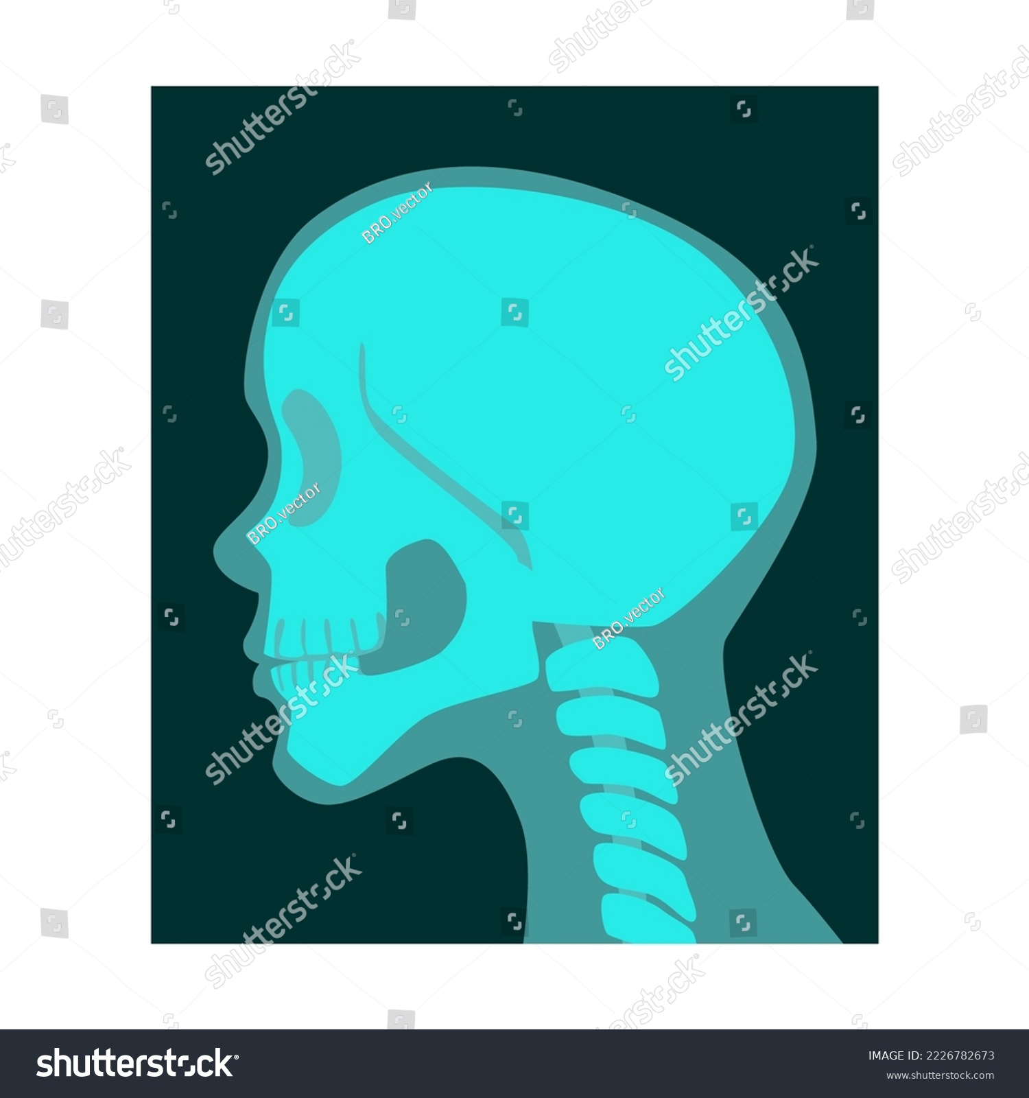 Ray Of Human Skull Side View Vector Illustration Royalty Free Stock Vector 2226782673 6489