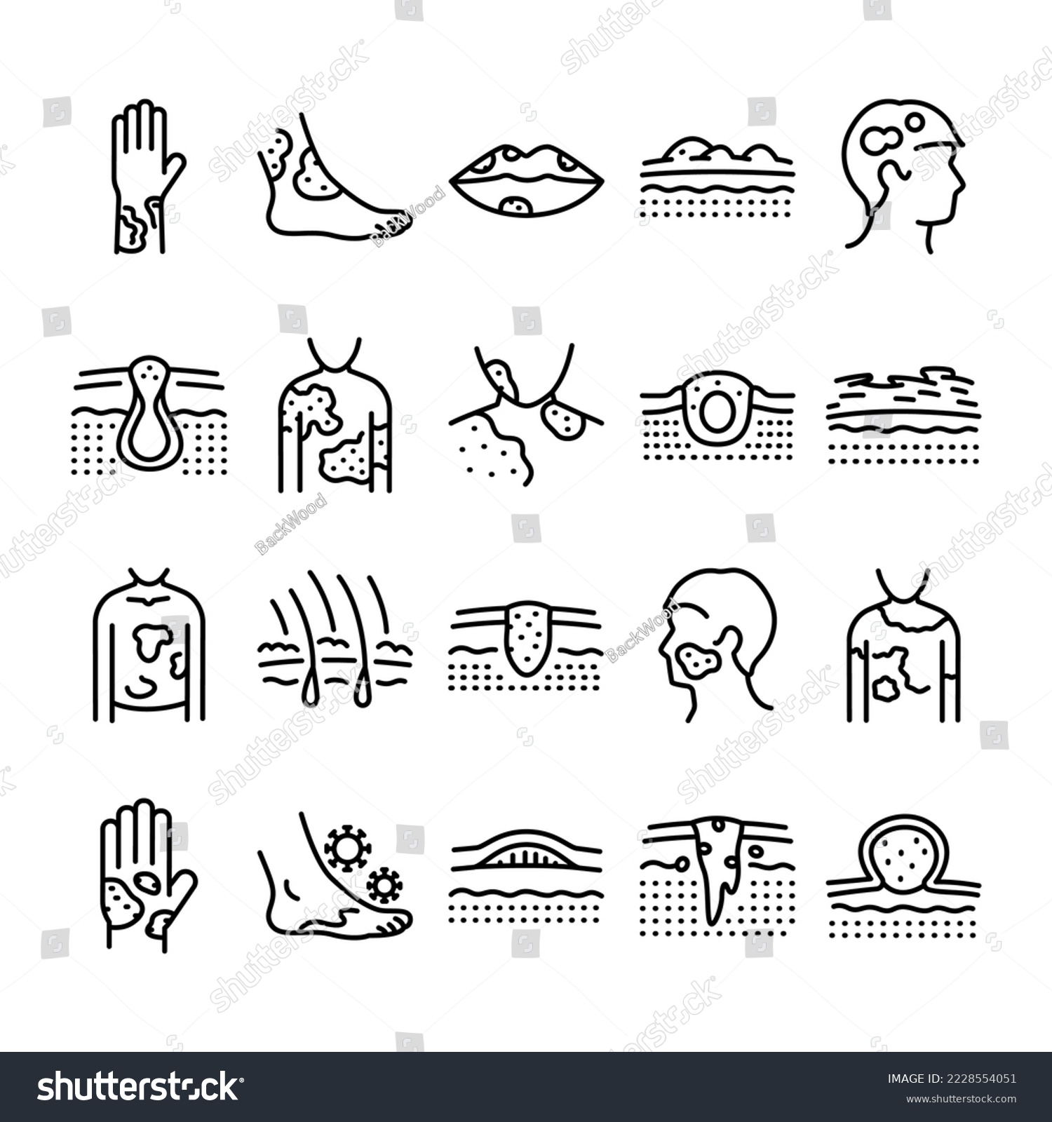 Skin Diseases Line Icons Set Dermatology Royalty Free Stock Vector