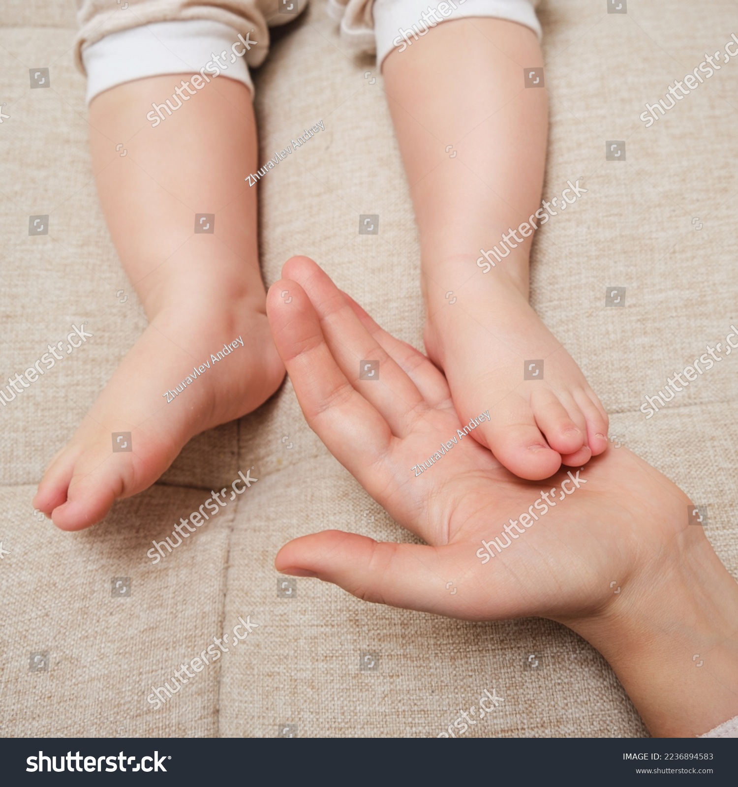 Deformed toes on the foot of the toddler baby, congenital curvature. Kid aged one year and three months #2236894583