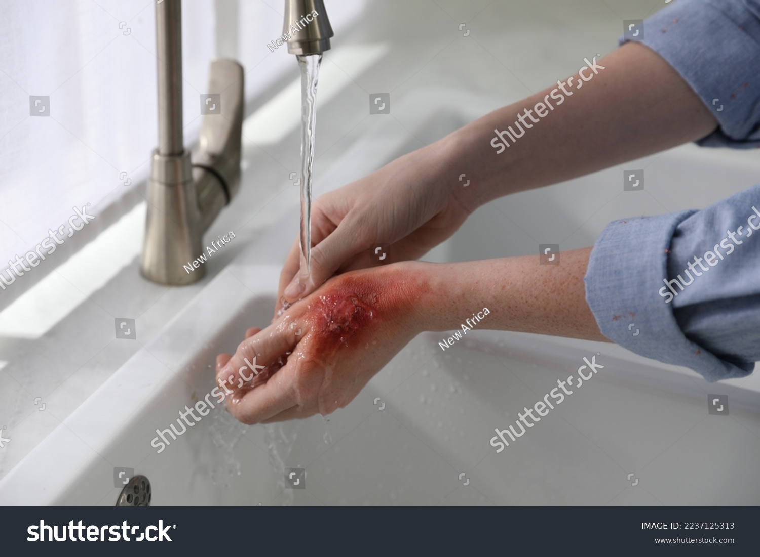 Woman holding hand with burn under flowing water indoors, closeup #2237125313
