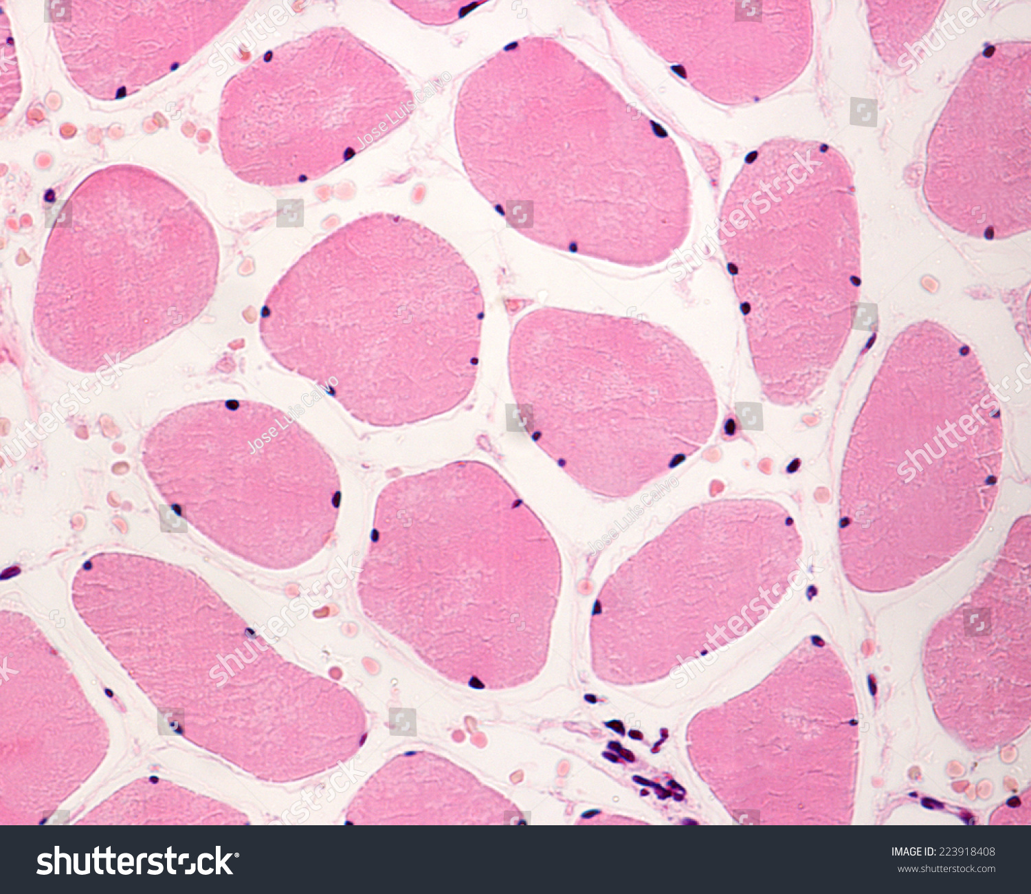 Skeletal striated muscle fibers in cross section showing the presence of several nuclei (multinucleated cells) located in the cell periphery. Light microscope photomicrograph #223918408
