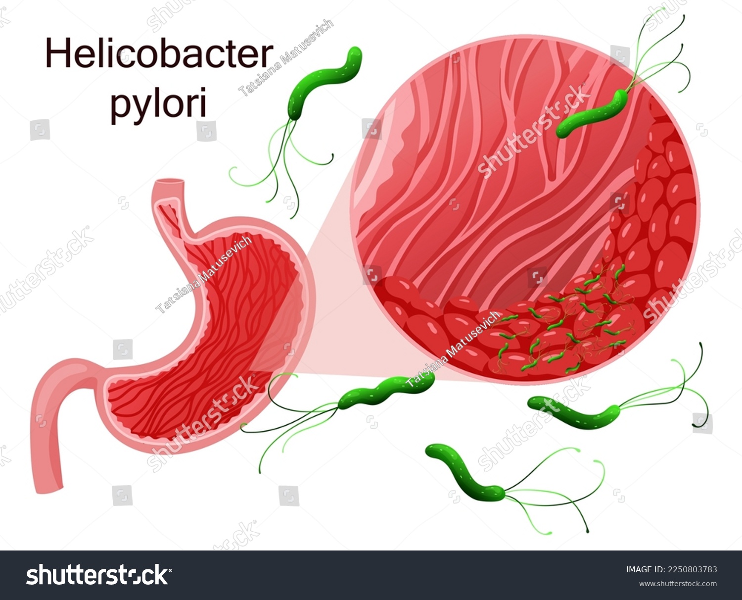 Helicobacter pylori in stomach epithelial cells - Royalty Free Stock ...