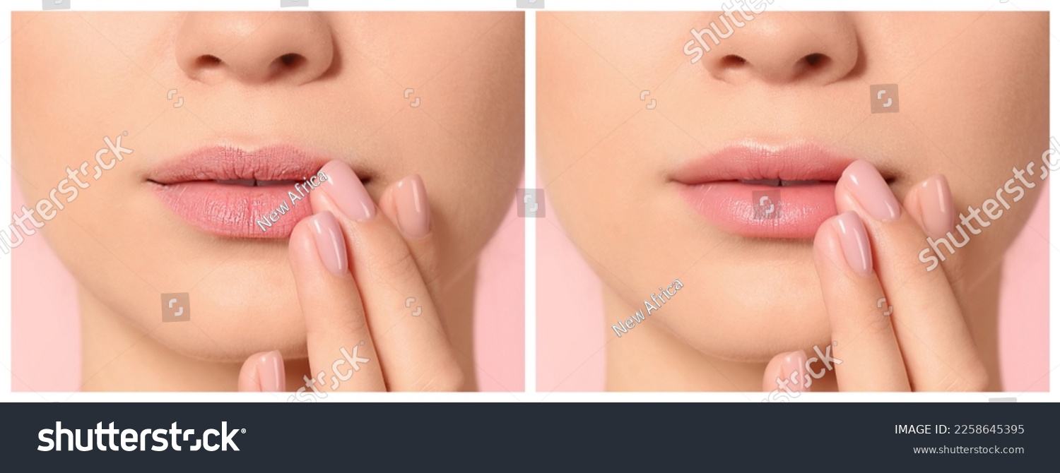 Collage with photos of woman before and after using lip balm on pink background, closeup #2258645395