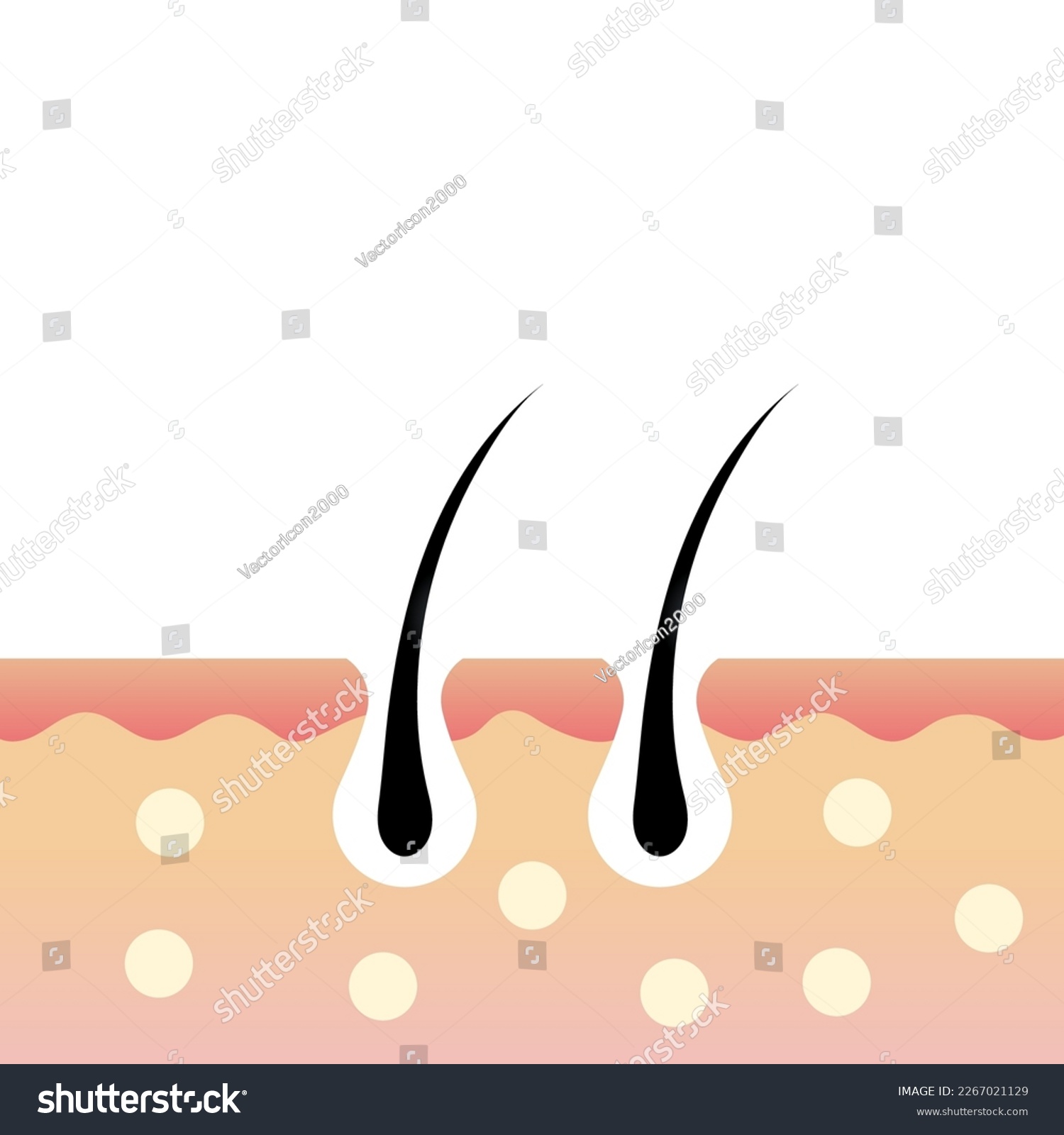 Hair follicles. The layers of skin or epidermis. - Royalty Free Stock ...