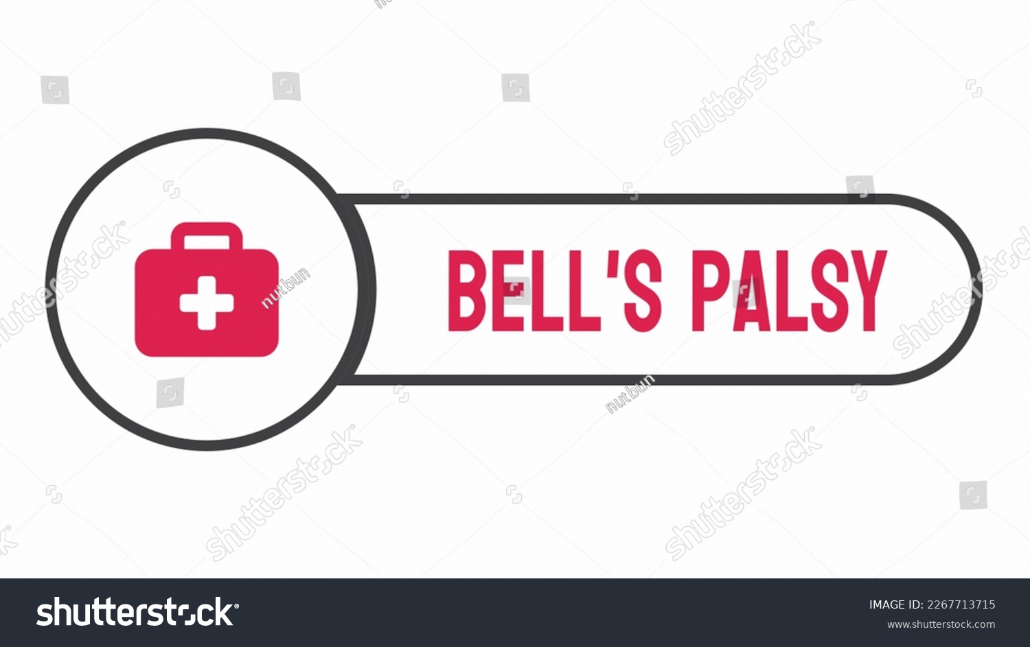 Bell's Palsy - A Temporary Facial Paralysis That - Royalty Free Stock 