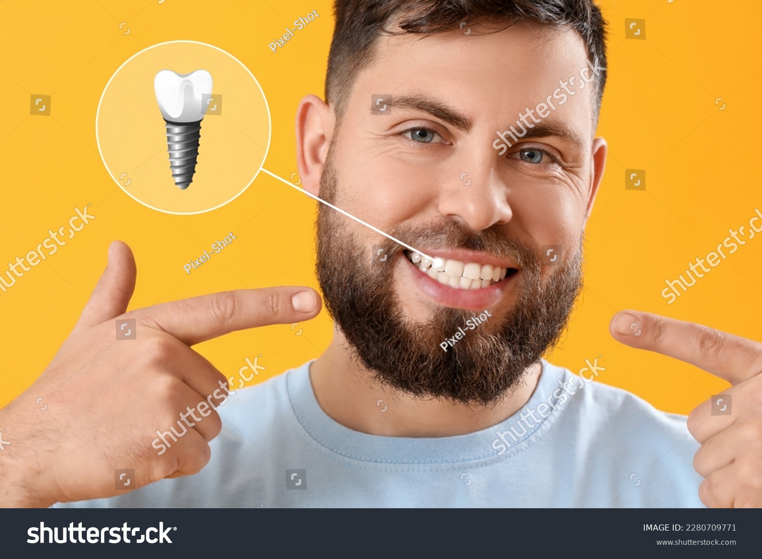 Young man with implanted teeth on yellow background #2280709771