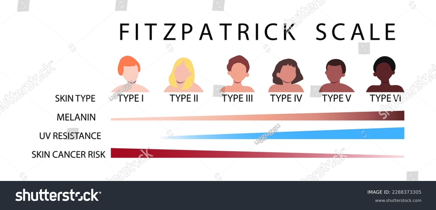 Fitzpatrick Scale. Skin Types Infographic With - Royalty Free Stock ...