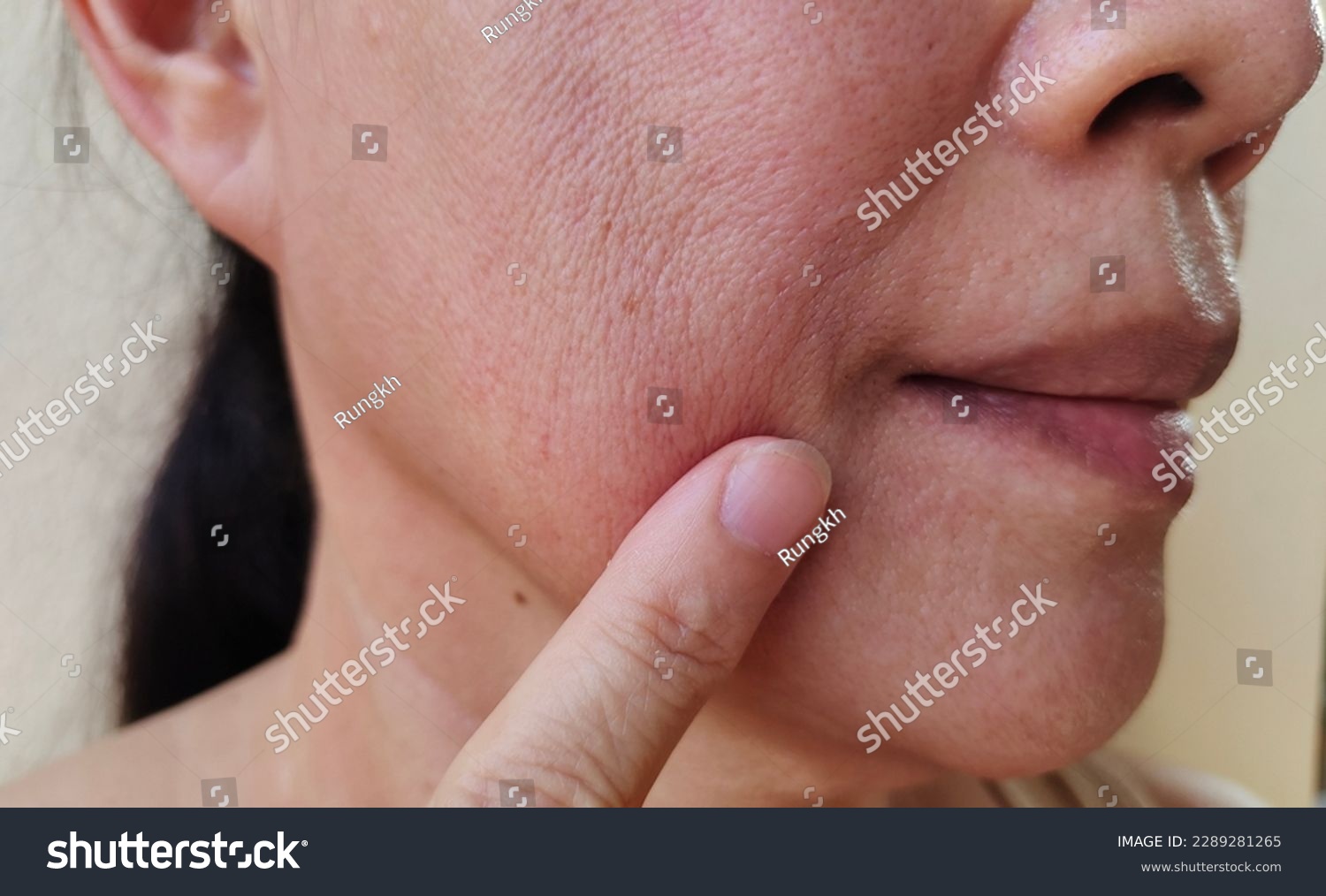 portrait the flabbiness and wrinkle  corner  of the mouth, smile lines and flabby skin beside the mouth , dark spots and dull skin, freckles and blemish on the face, health care and beauty concept. #2289281265