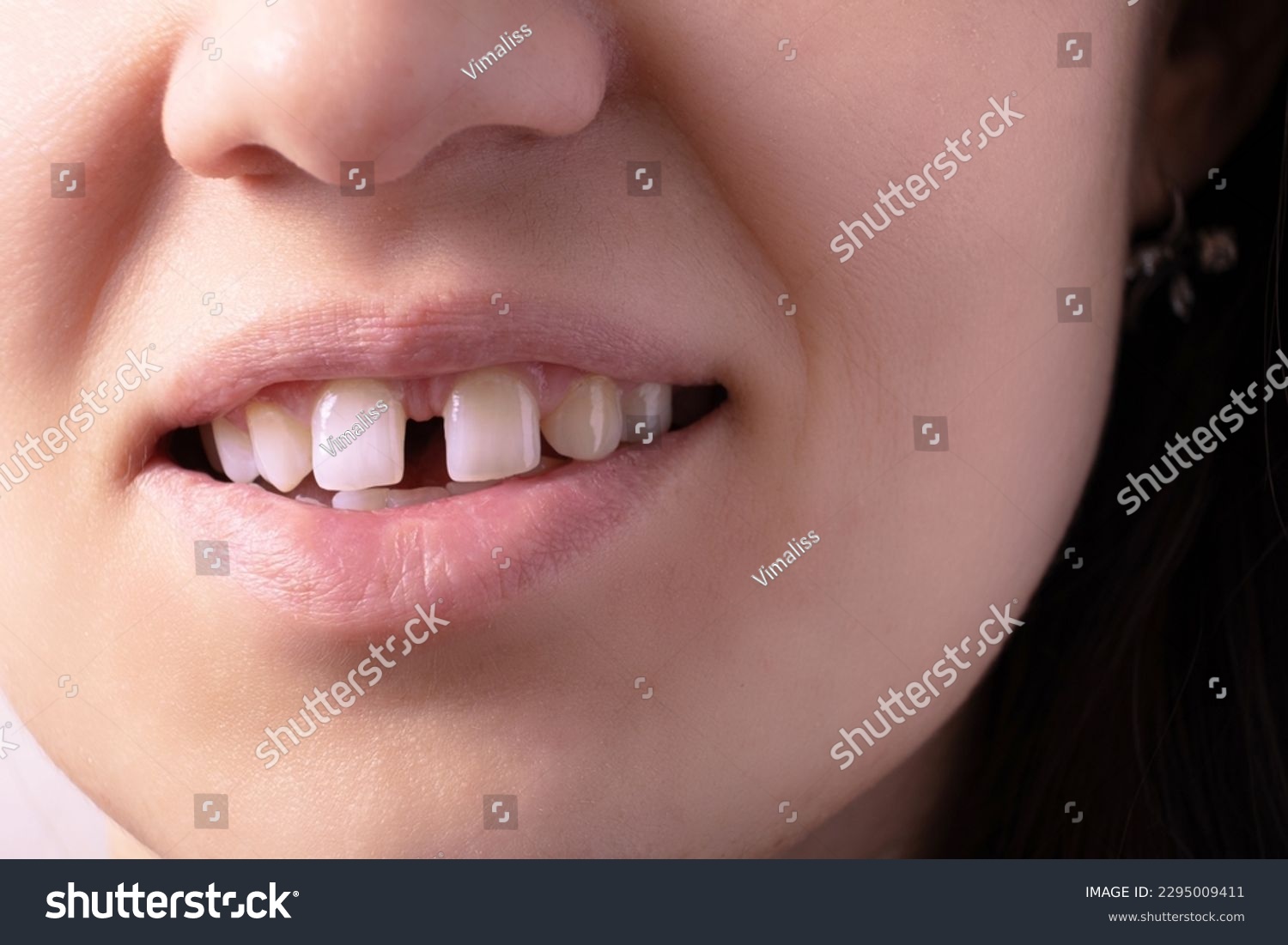 Close up of woman's open smiling mouth with gap teeht. Lips and unusual teeth. #2295009411