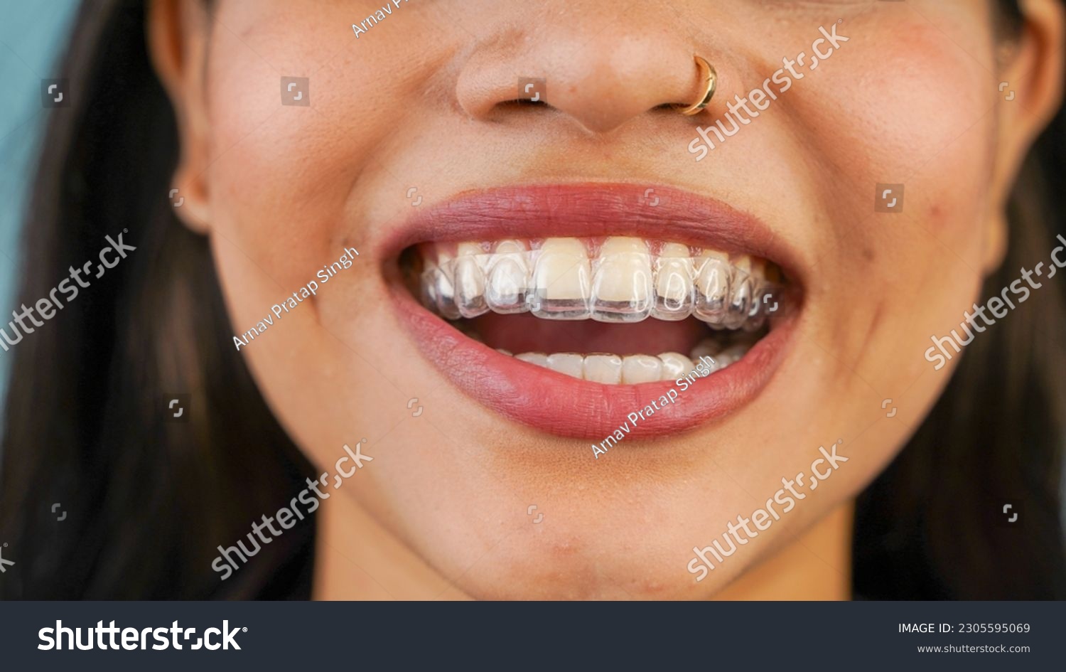 Young Asian Indian woman holding removable invisible aligner, also known as invisalign or  clear aligner #2305595069