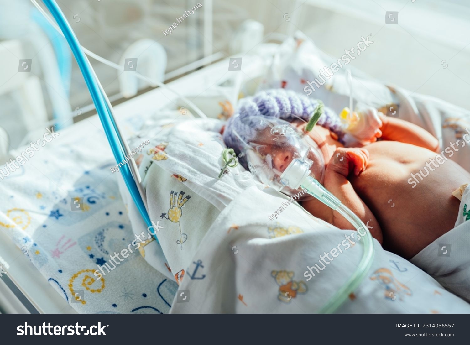 Child health, small newborn child lies in pressure chamber connected to an artificial respiration apparatus. #2314056557
