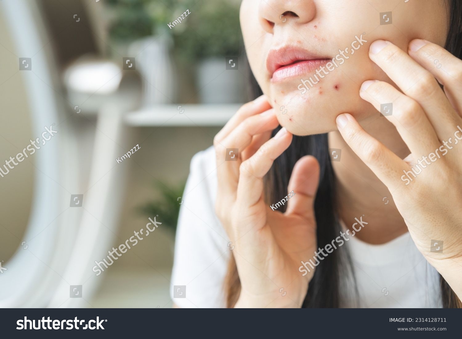 Expression worry asian young woman looking at mirror touching pustule around the chin and mouth, allergic when wear mask, spot scar from pimple on face. Beauty care, skin problem by acne treatment. #2314128711