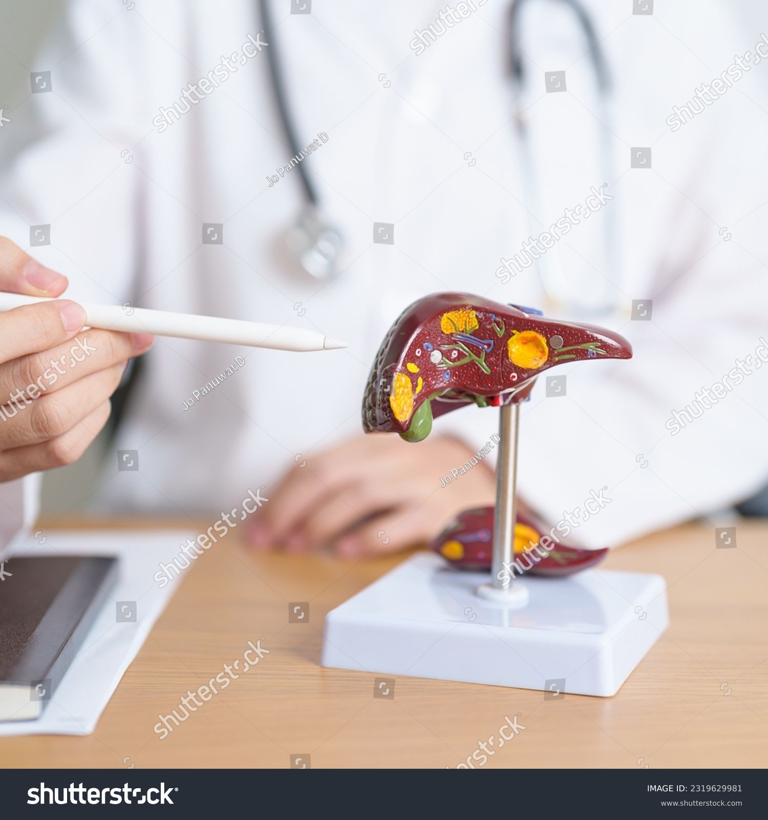 Doctor with human Liver anatomy model. Liver cancer and Tumor, Jaundice, Viral Hepatitis A, B, C, D, E, Cirrhosis, Failure, Enlarged, Hepatic Encephalopathy, Ascites Fluid in Belly and health concept #2319629981