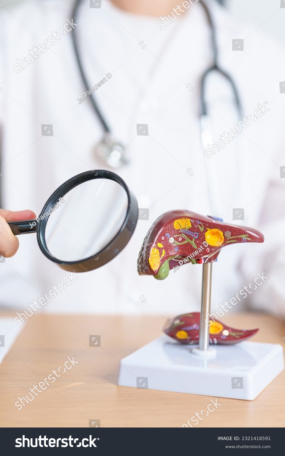 Doctor with human Liver model and Magnifying glass. Liver cancer and Tumor, Jaundice, Viral Hepatitis A, B, C, D, E, Cirrhosis, Failure, Enlarged, Hepatic Encephalopathy and Ascites Fluid in Belly #2321418591
