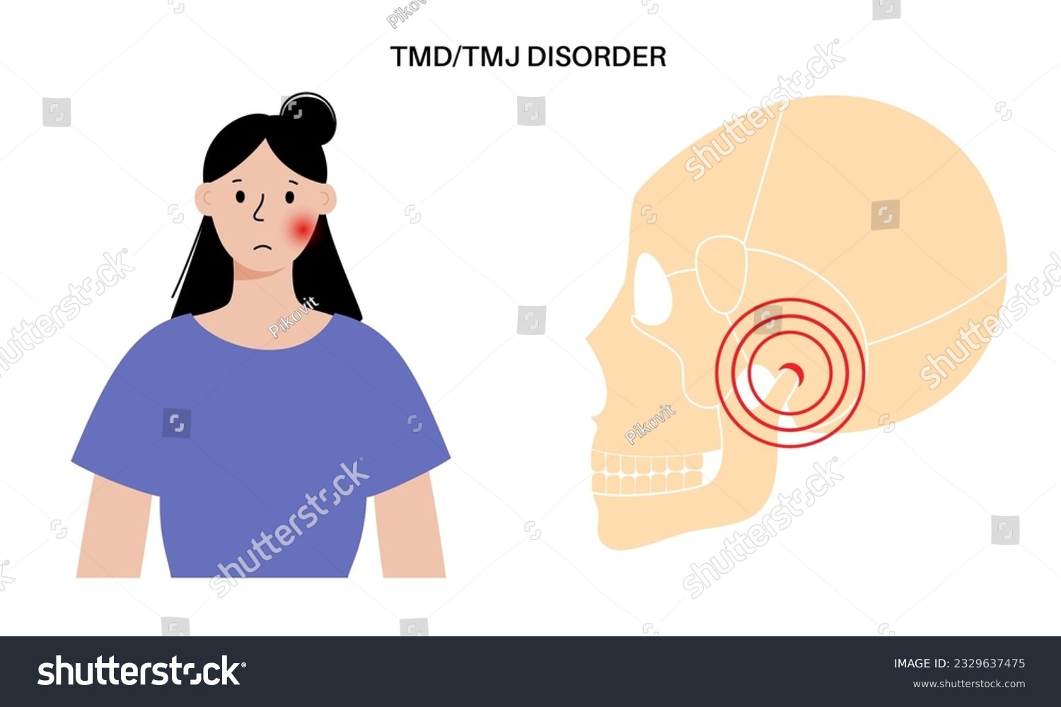 Temporomandibular joint disorder. TMD or TMJ - Royalty Free Stock ...