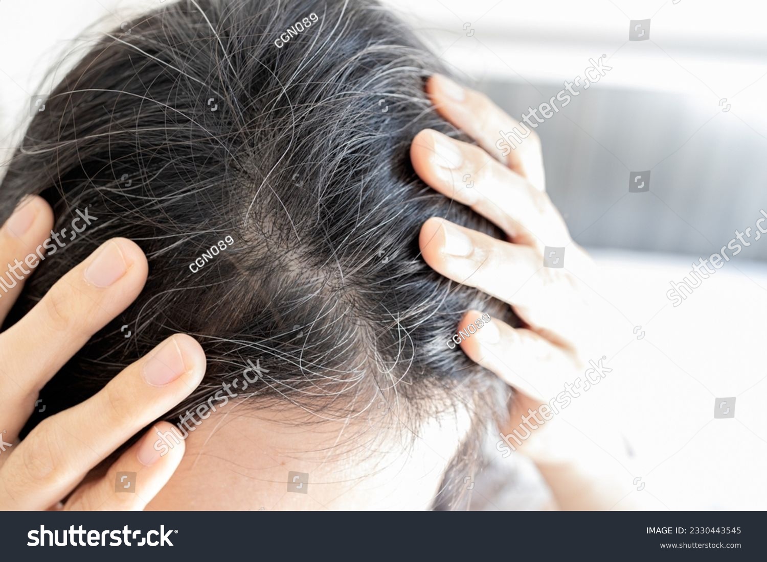 Premature gray hair problem,stressed asian young woman with hair loss,thyroid or autoimmune disorders,alopecia areata,deficiency of vitamins,concerned about graying hair,health care,medical concept #2330443545