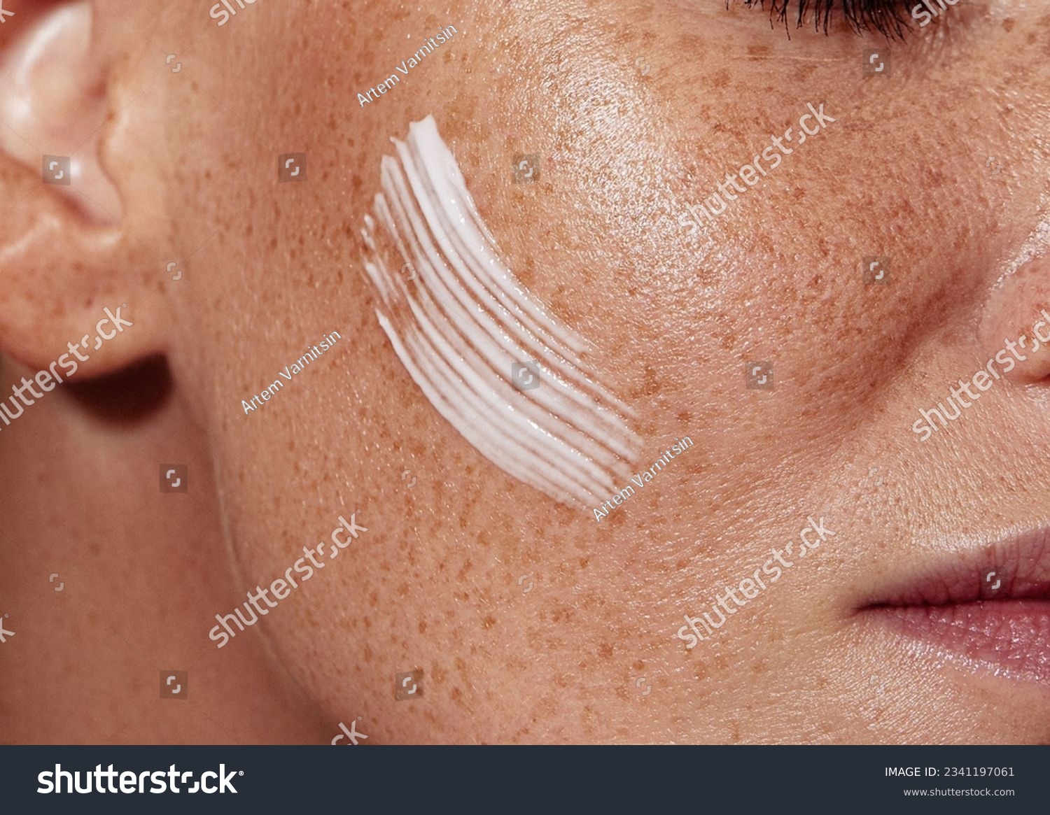 Close-up shot of female skin with freckles with white cream #2341197061
