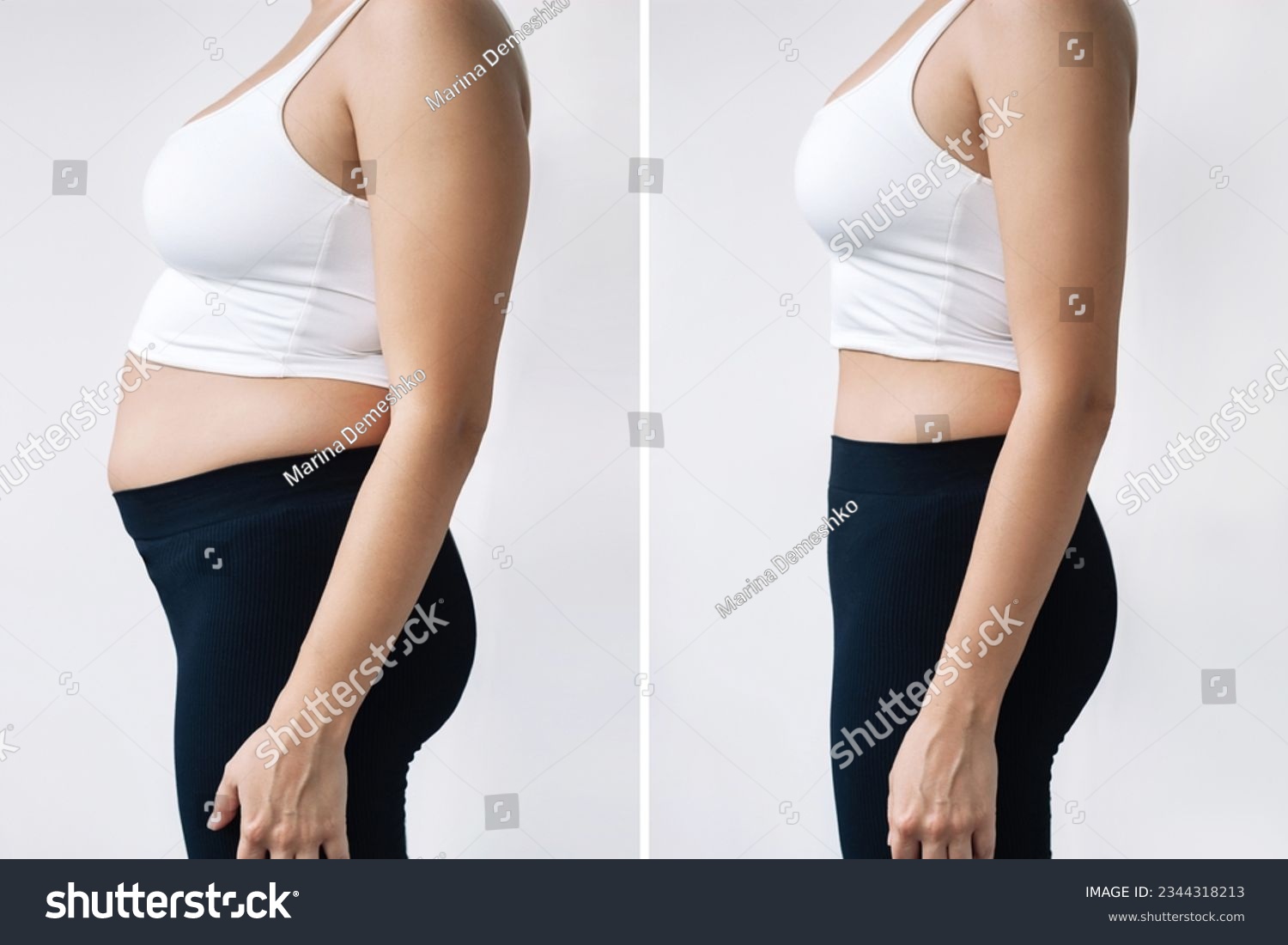 Two shots of a woman in profile with a belly with excess fat and toned slim stomach before and after losing weight on gray background. Result of diet, liposuction, training. Getting rid of overweight #2344318213