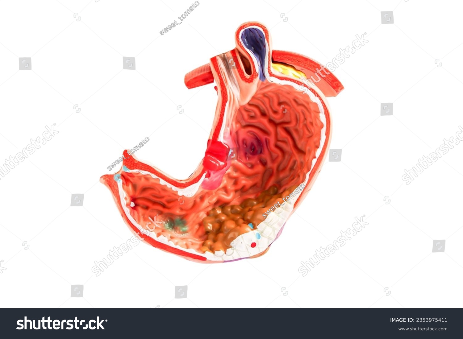 Stomach model isolated on white background with clipping path, anatomy model for study diagnosis and treatment in hospital. #2353975411