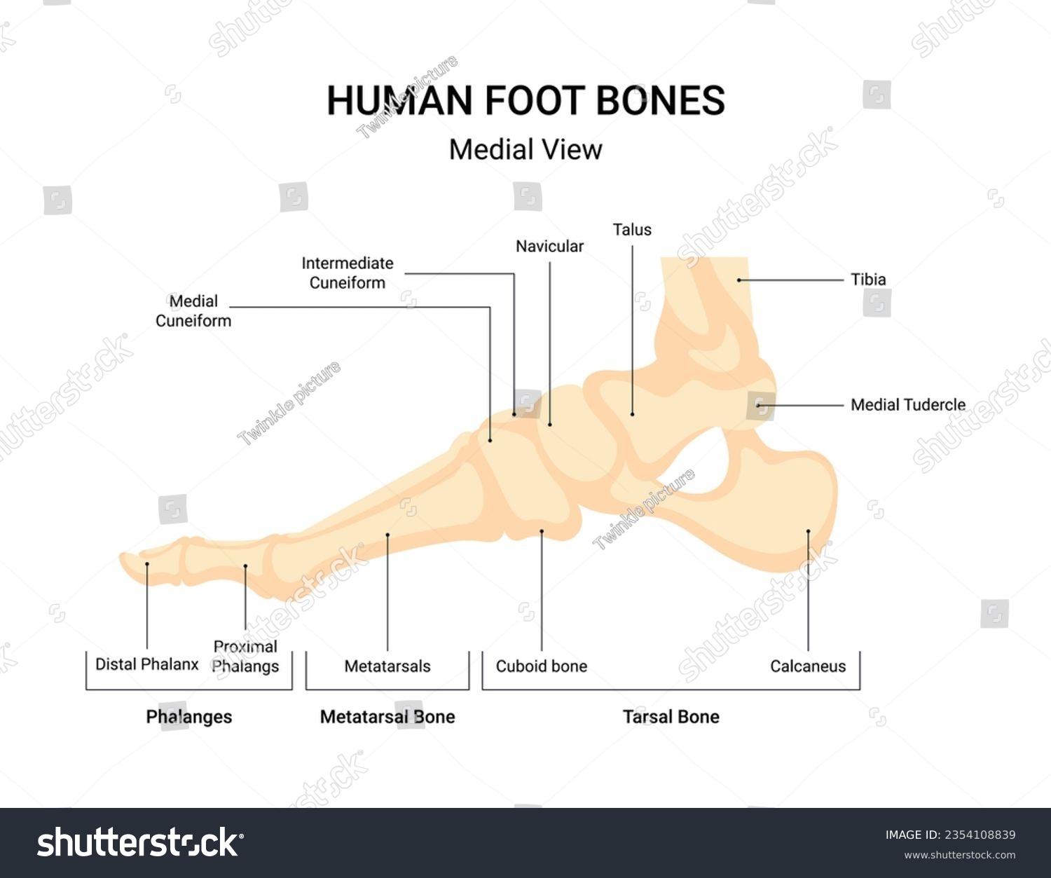 Human leg bone system infographic - Royalty Free Stock Vector ...