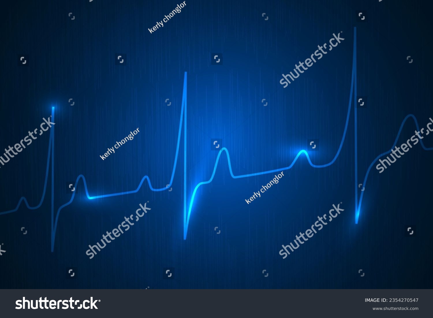 Normal heartbeat lines digital technology abstract background. #2354270547
