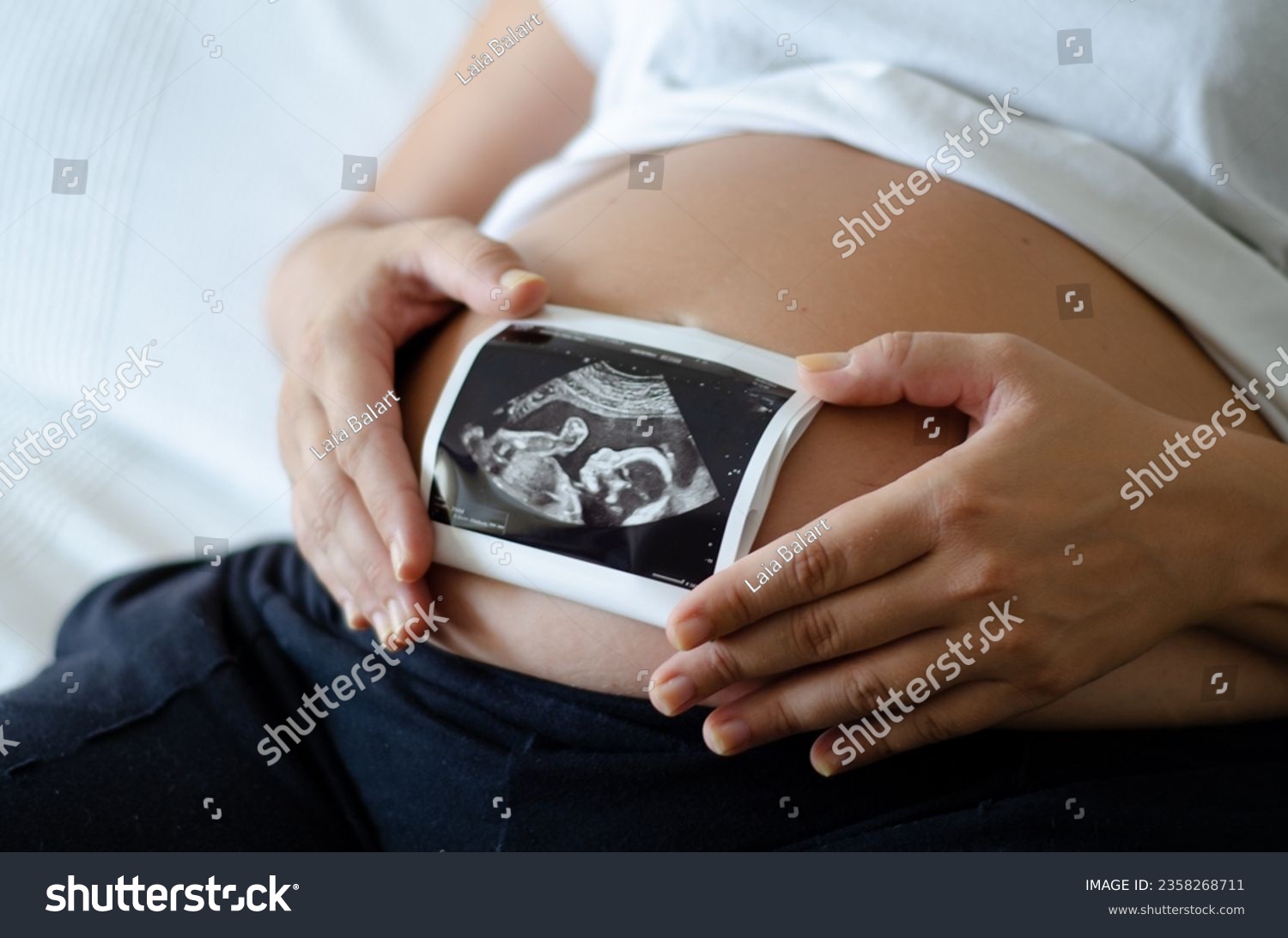 Pregnant woman holding an ultrasound image of the baby. Close-up of pregnant belly and ultrasound photography in mother's hands. Untied and healthy pregnancy concept #2358268711