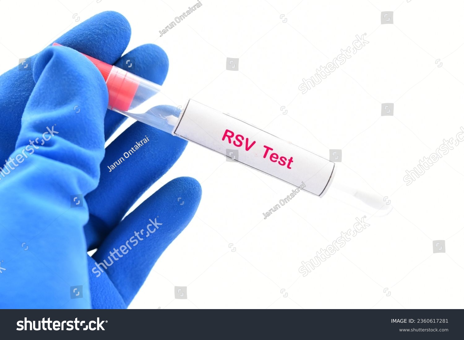 Nasopharyngeal swab from patient for respiratory syncytial virus (RSV) test  #2360617281