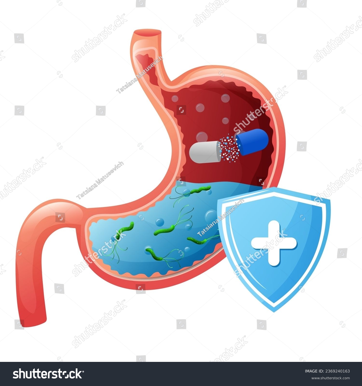 Human stomach with drug capsule and helicobacter - Royalty Free Stock ...