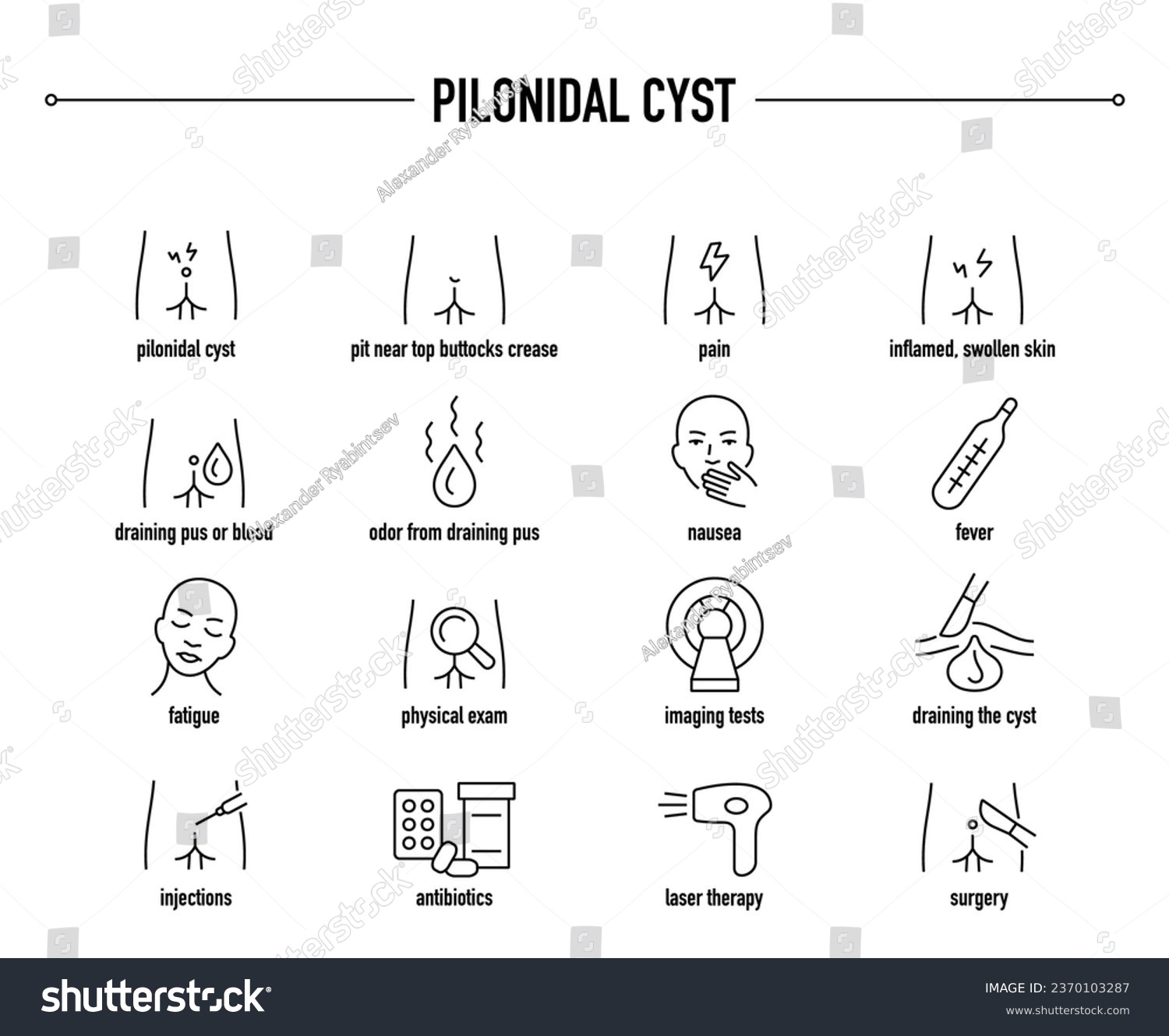 Pilonidal Cyst Symptoms Diagnostic And Royalty Free Stock Vector 2370103287 6563