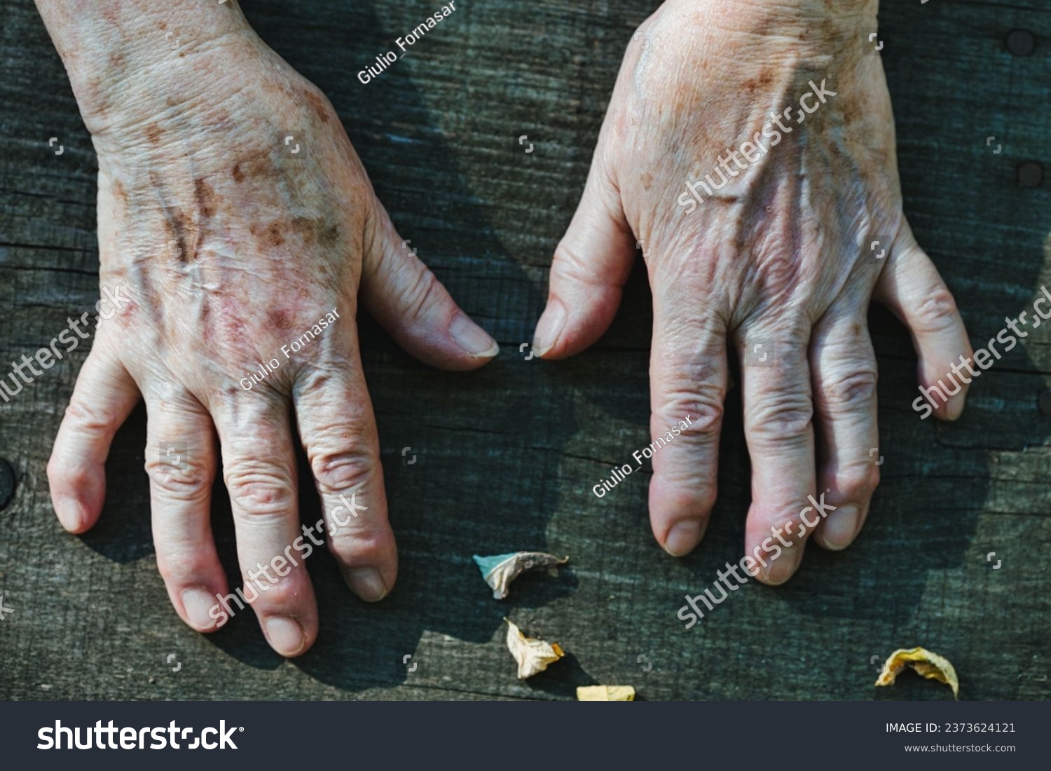 Elderly hands, showcasing a life's journey through their blemishes and creases, rest in a calming forest environment, contrasting with the surroundings #2373624121