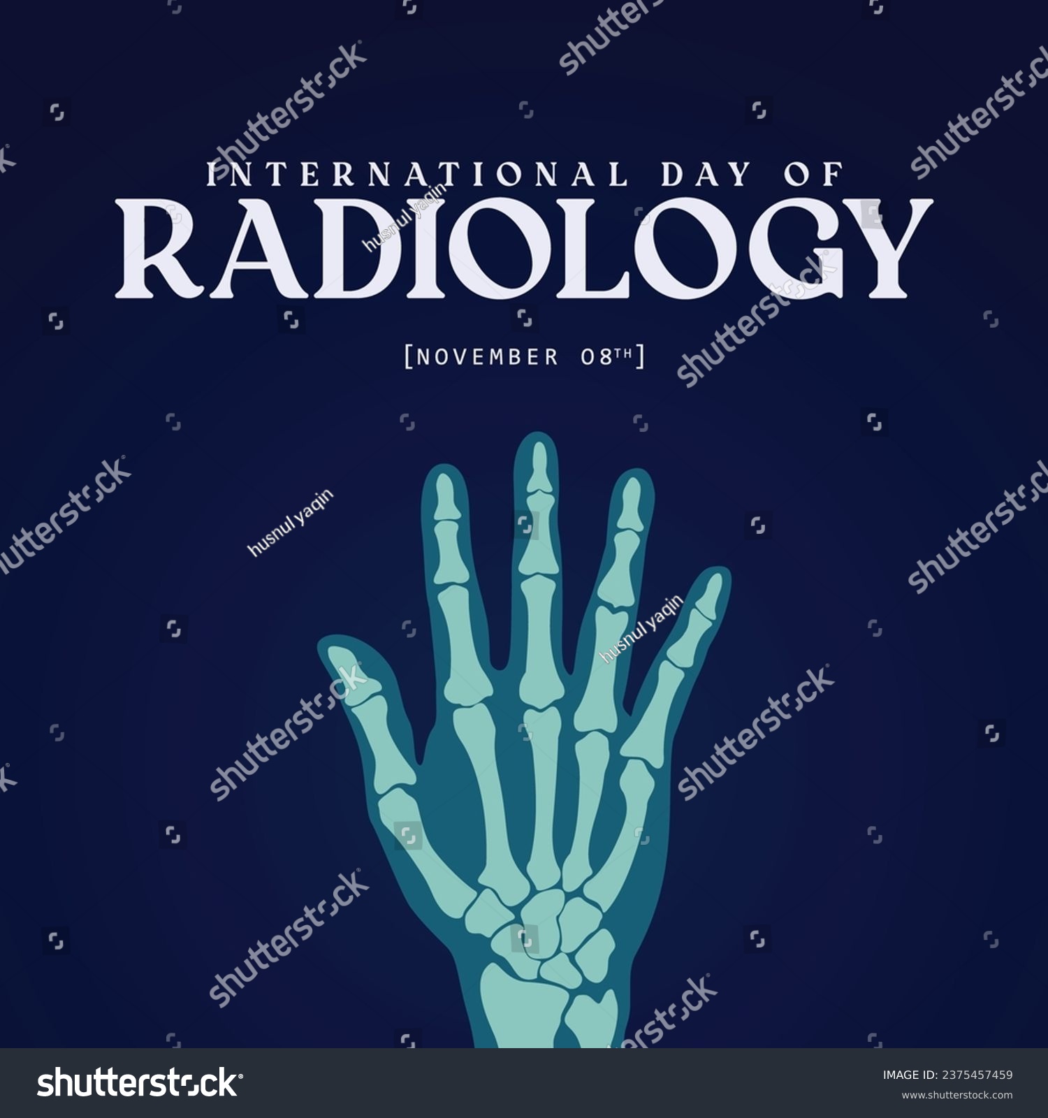 International day of radiology. Hand bone x-ray - Royalty Free Stock ...