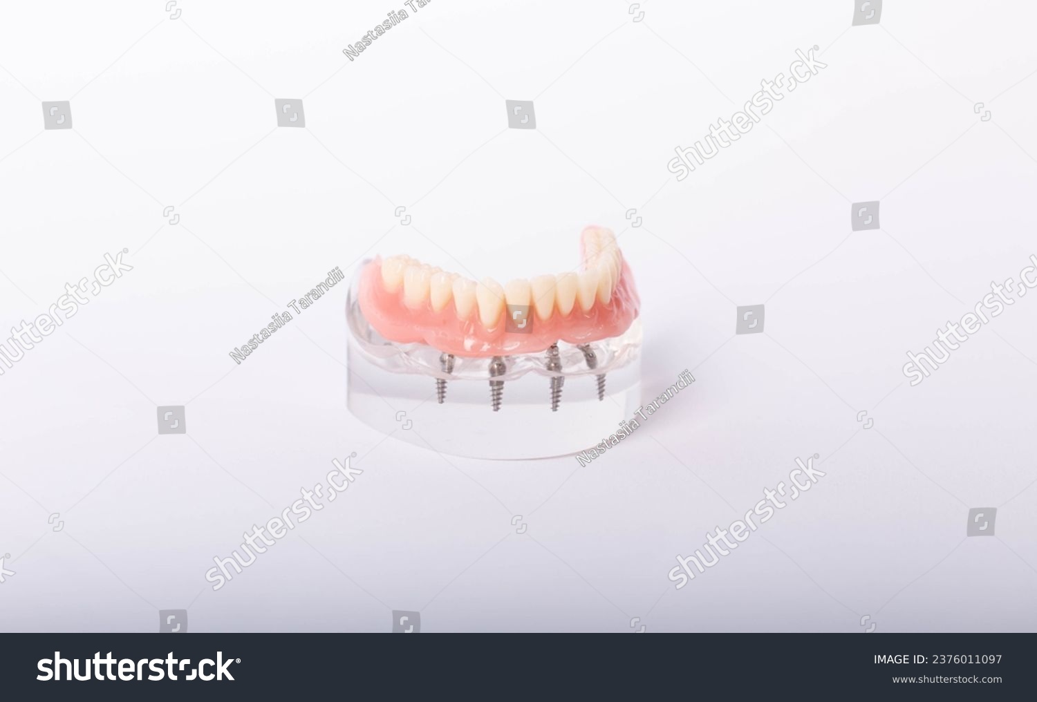 render of mandibular prosthesis all on 4 system supported by implants over white background #2376011097