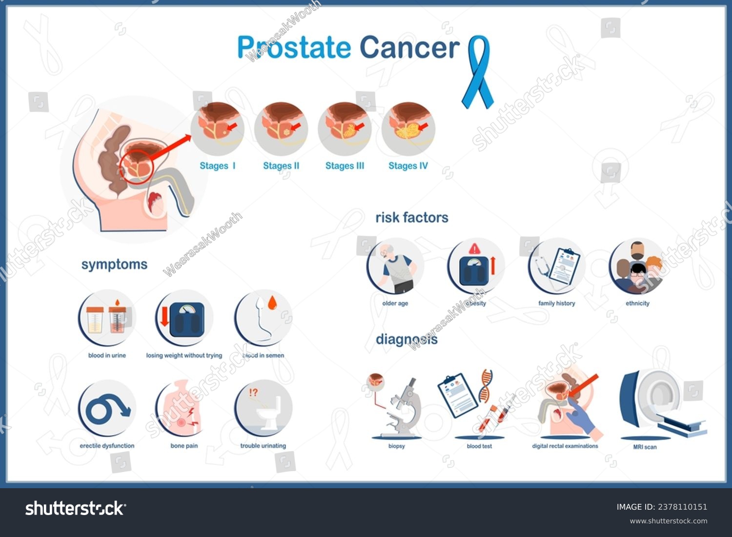 Flat vector concept Medical infographic - Royalty Free Stock Vector ...