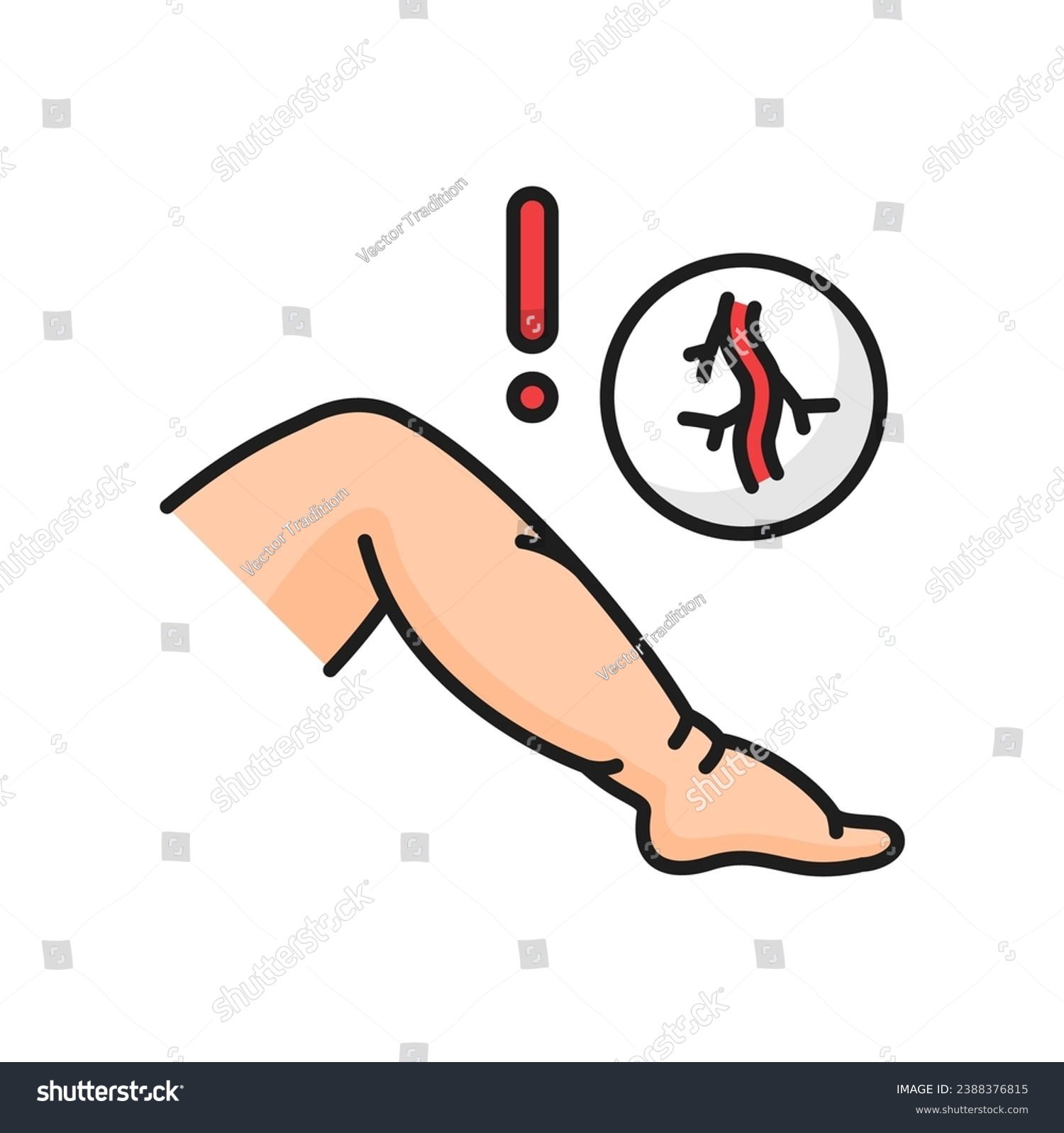 Venous disease edema color line line icon. - Royalty Free Stock Vector ...