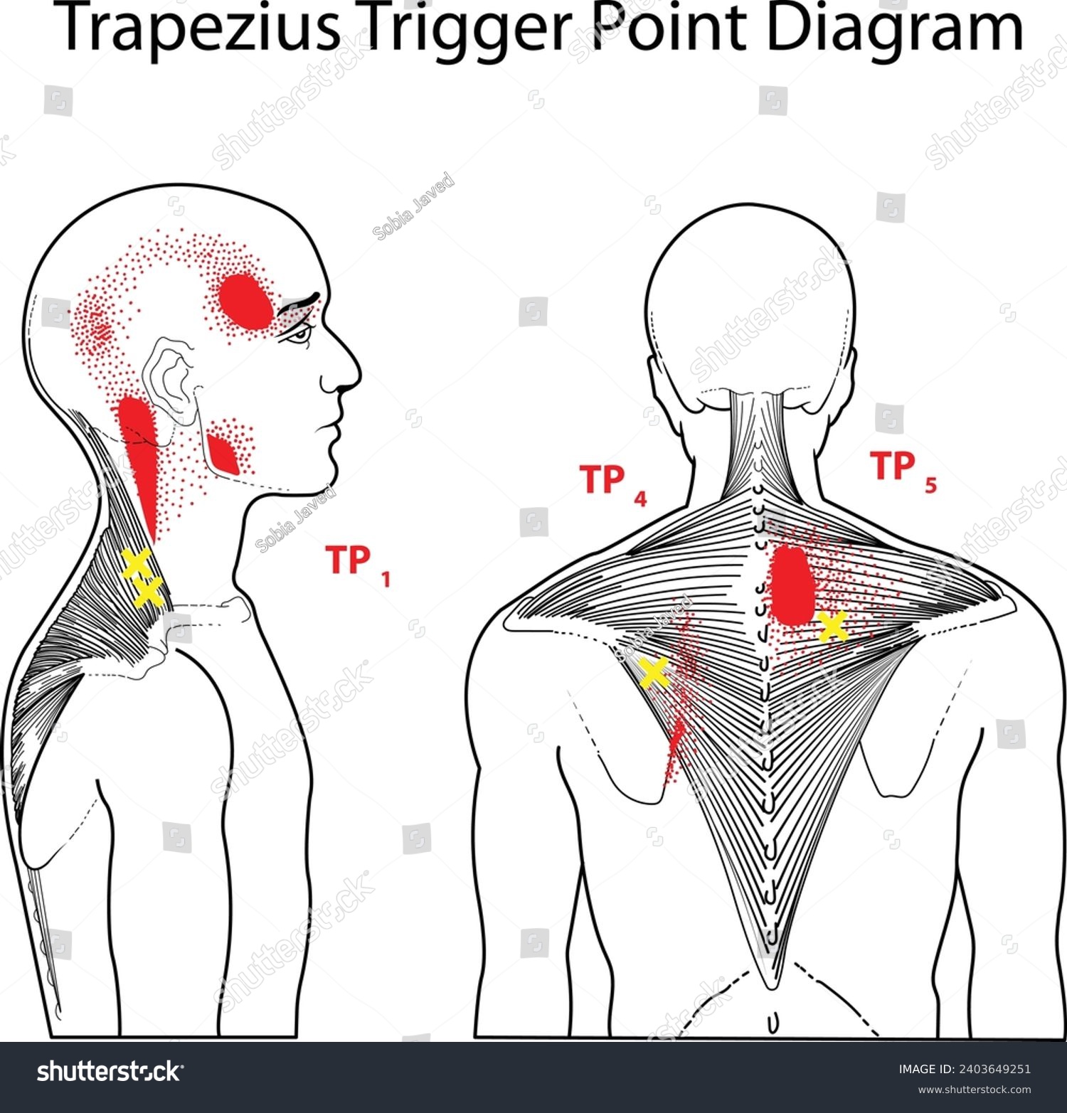 Trapezius Trigger Point Diagram Vector - Royalty Free Stock Vector ...