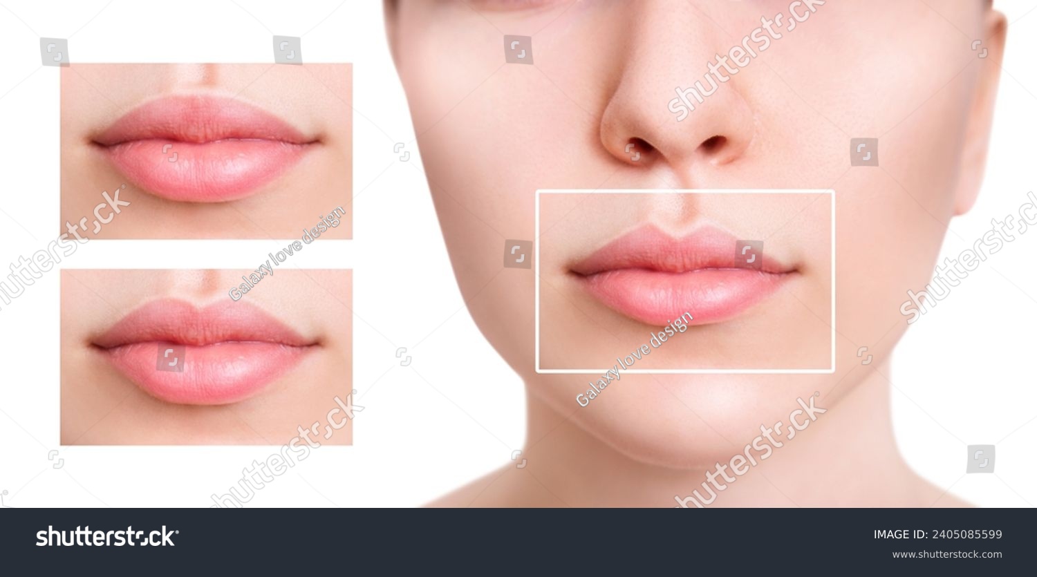 Young woman near set of different lips shapes. Shape of the lips concept. #2405085599