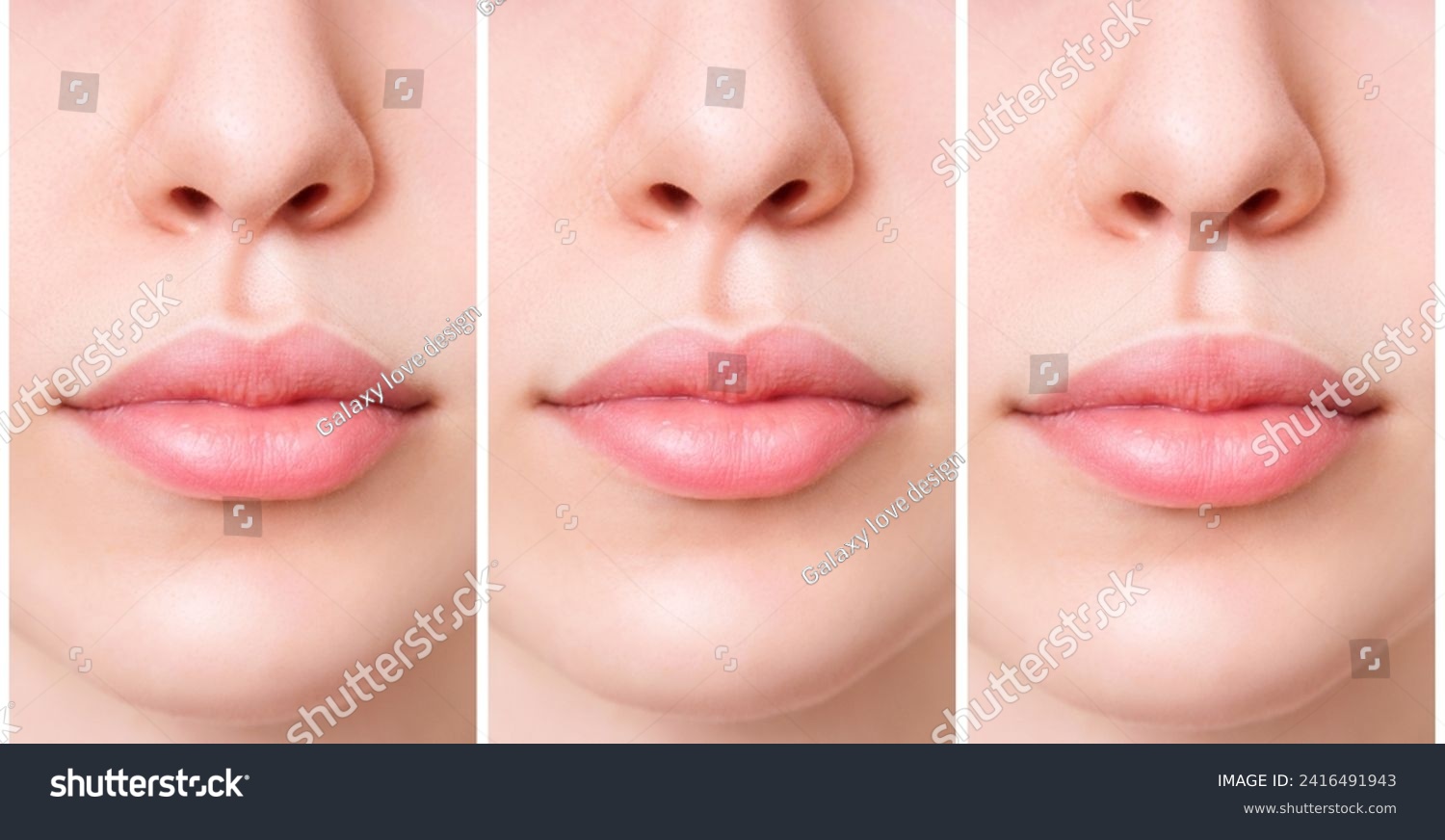 Lips of young woman near set of different female lips. #2416491943
