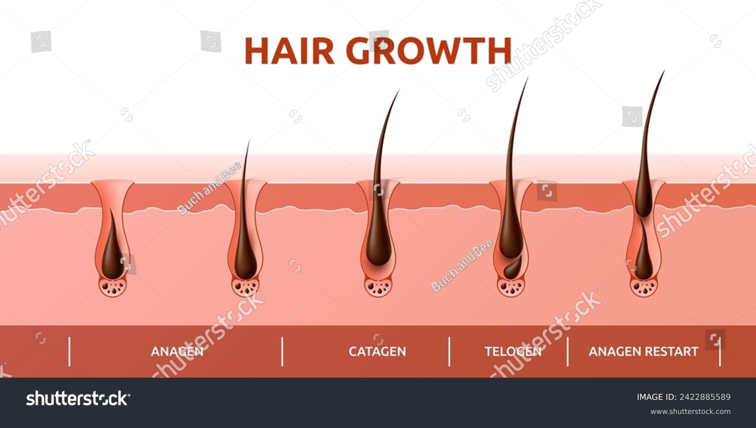 Hair growth cycle of follicles phase diagram - Royalty Free Stock ...